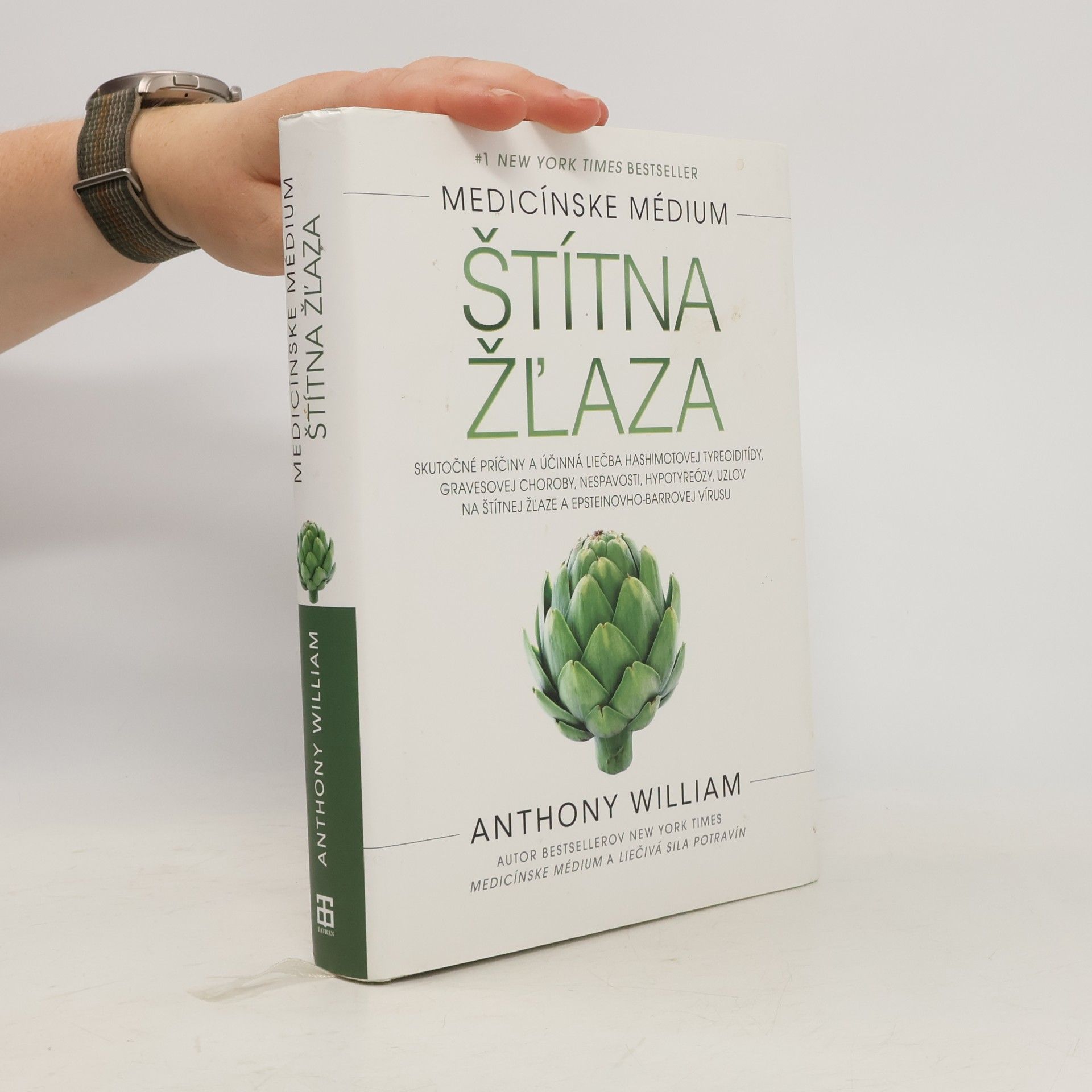 Anthony William Štítna žľaza