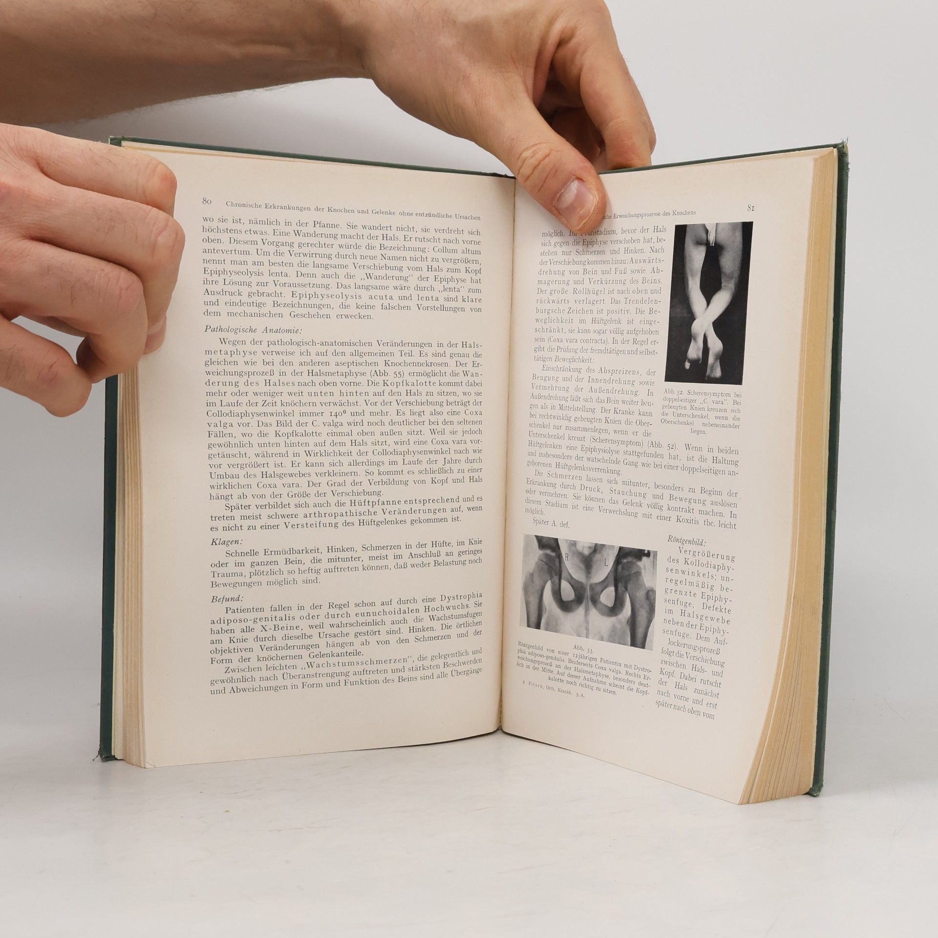 Peter Pitzen Kurzgefafites Lehrbuch der Orthopädischen Krankheiten