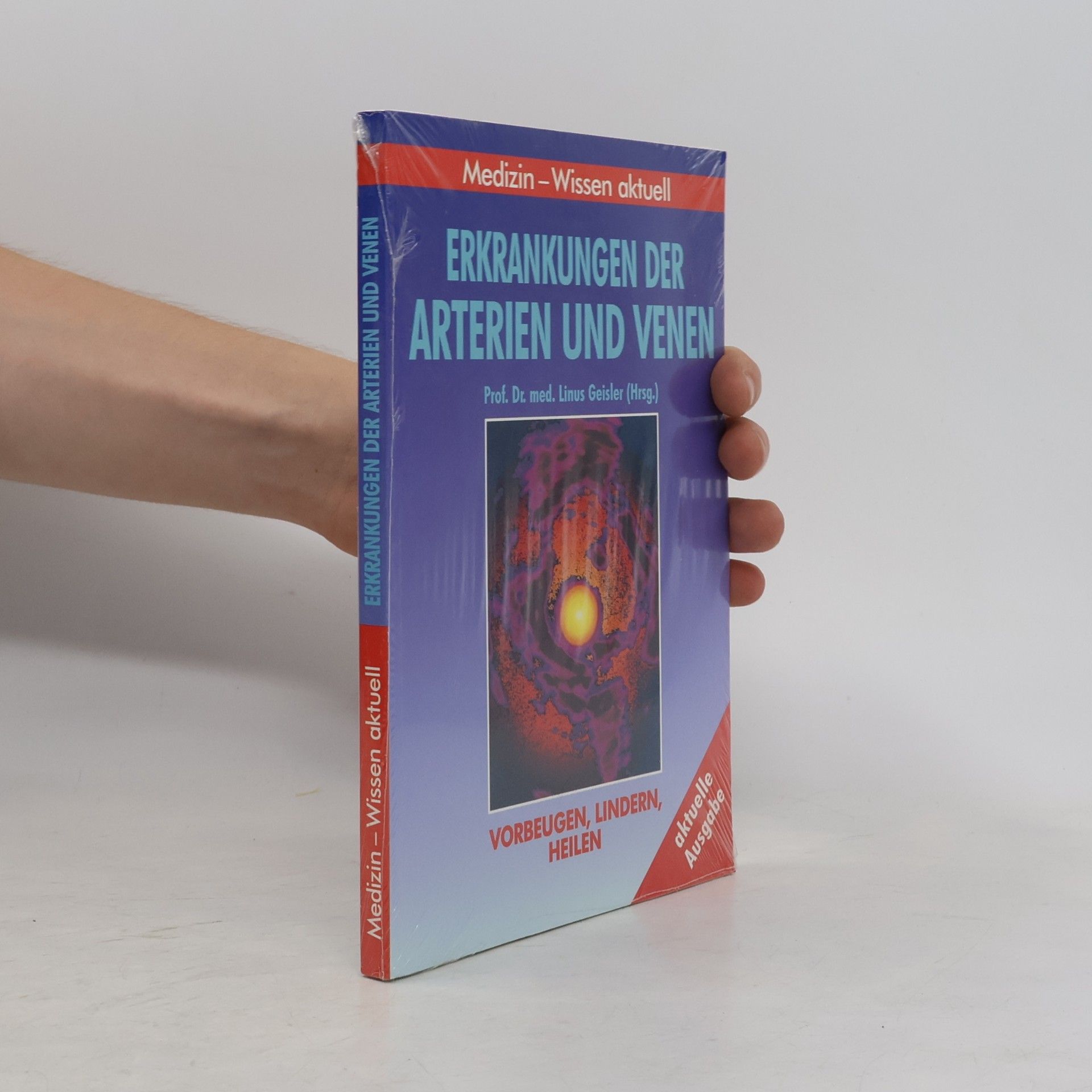 Erkrankungen der Arterien und Venen.