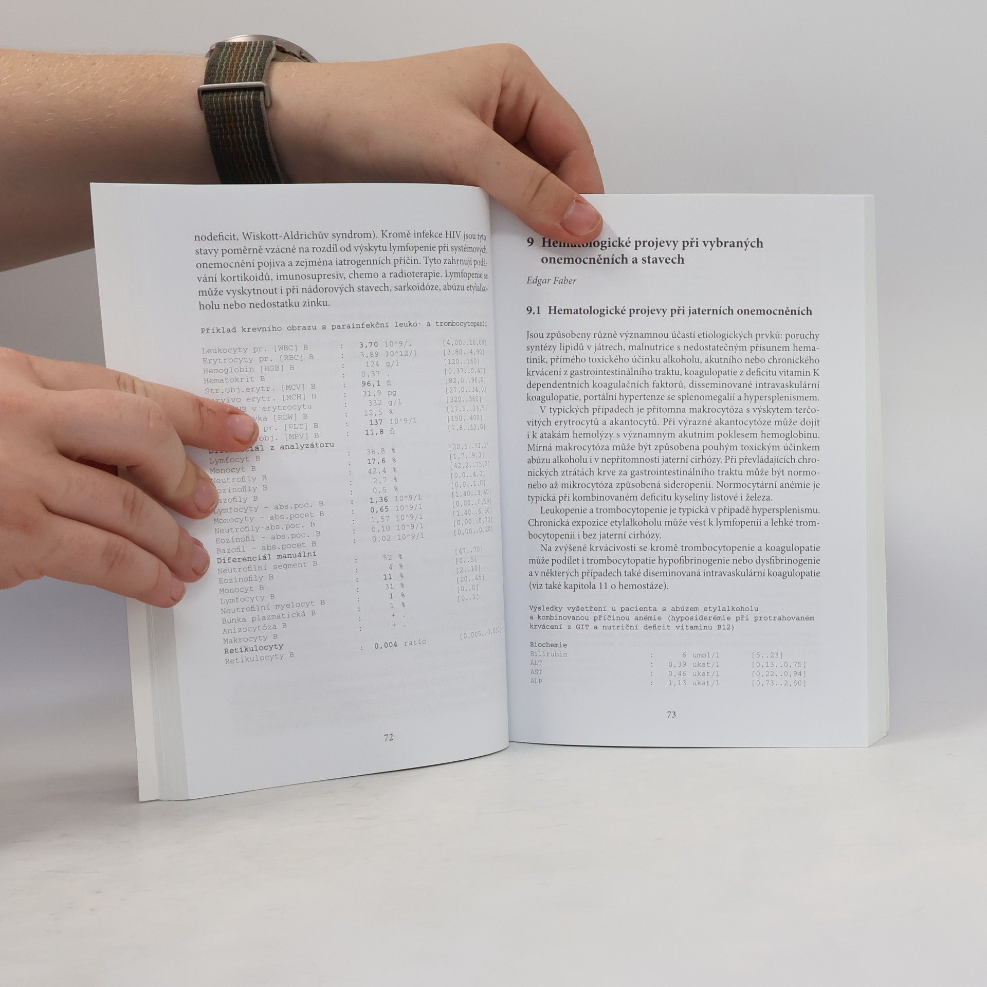 Edgar Faber Základy hematologické diagnostiky