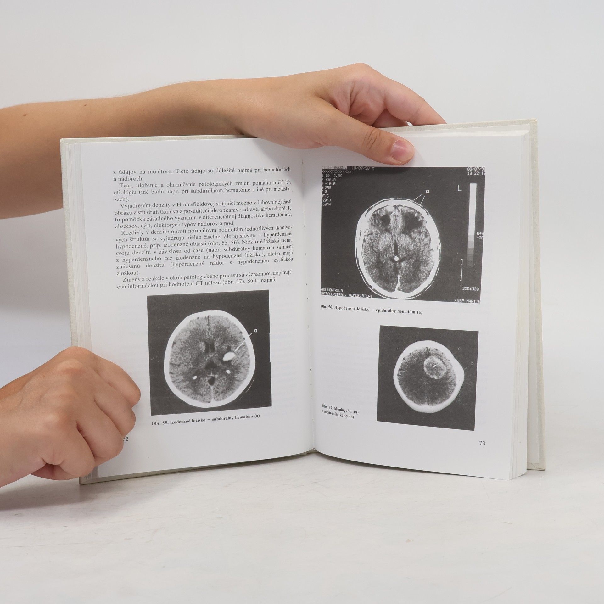 Autorenkollektiv Moderné zobrazovacie metódy v lekárskej diagnostice