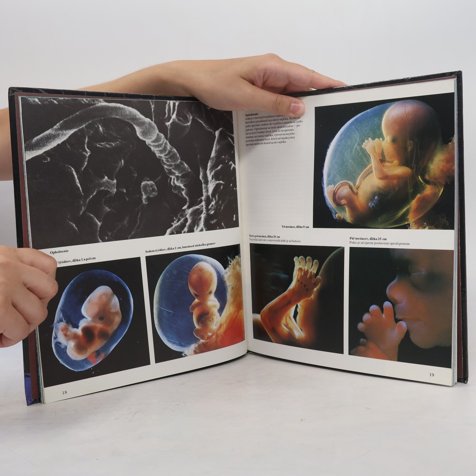 Auteurscollectief Ako sa nepoznáme: Objavná cesta s fotografickým aparátom do nášho tela