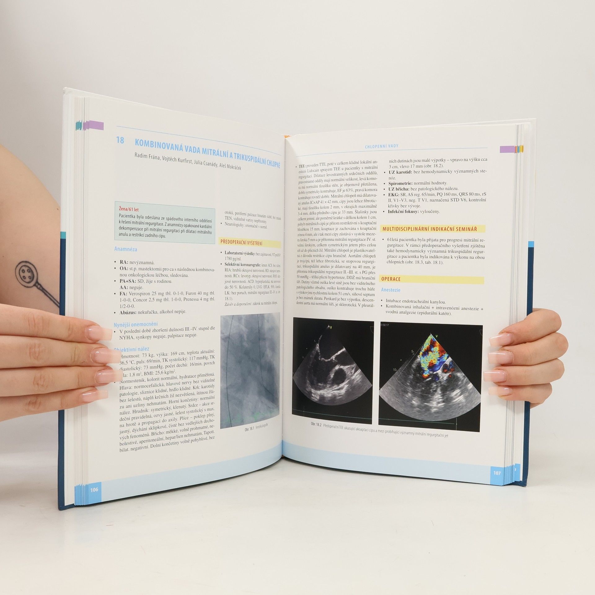 Vojtěch Kurfirst Kardiochirurgie v instruktivních kazuistikách
