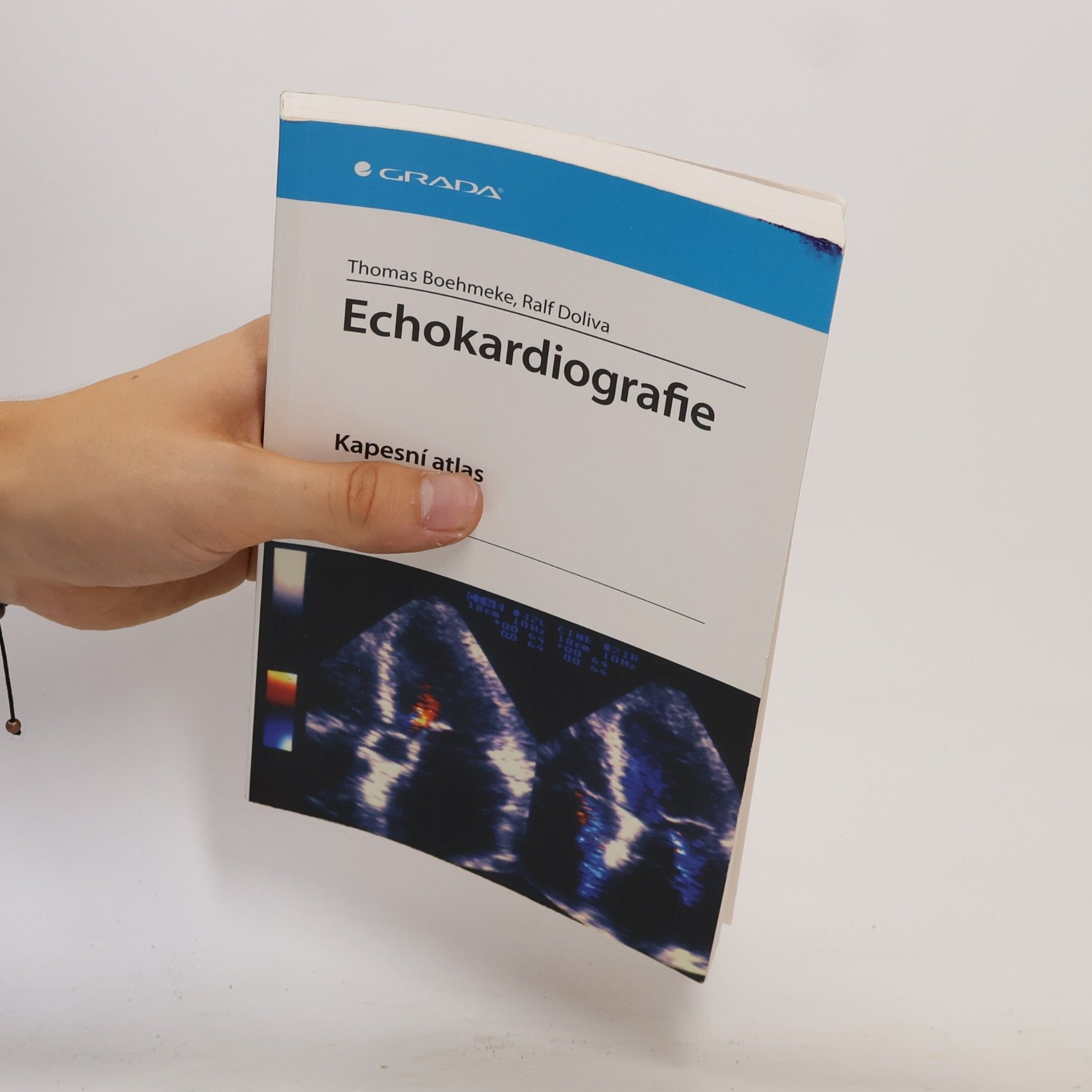 Thomas Boehmeke Echokardiografie : kapesní atlas