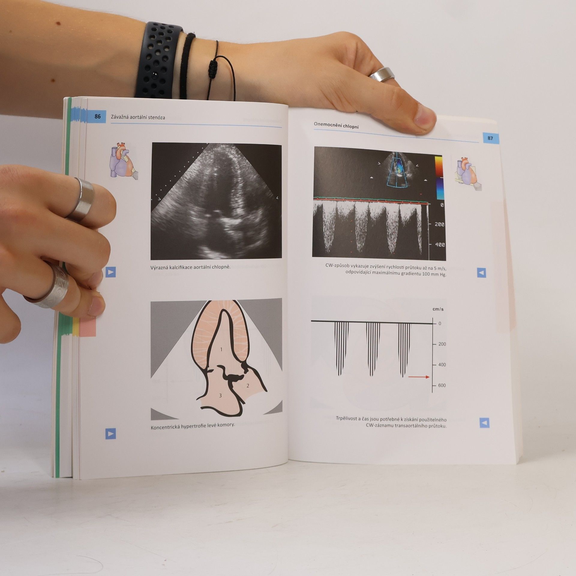 Thomas Boehmeke Echokardiografie : kapesní atlas