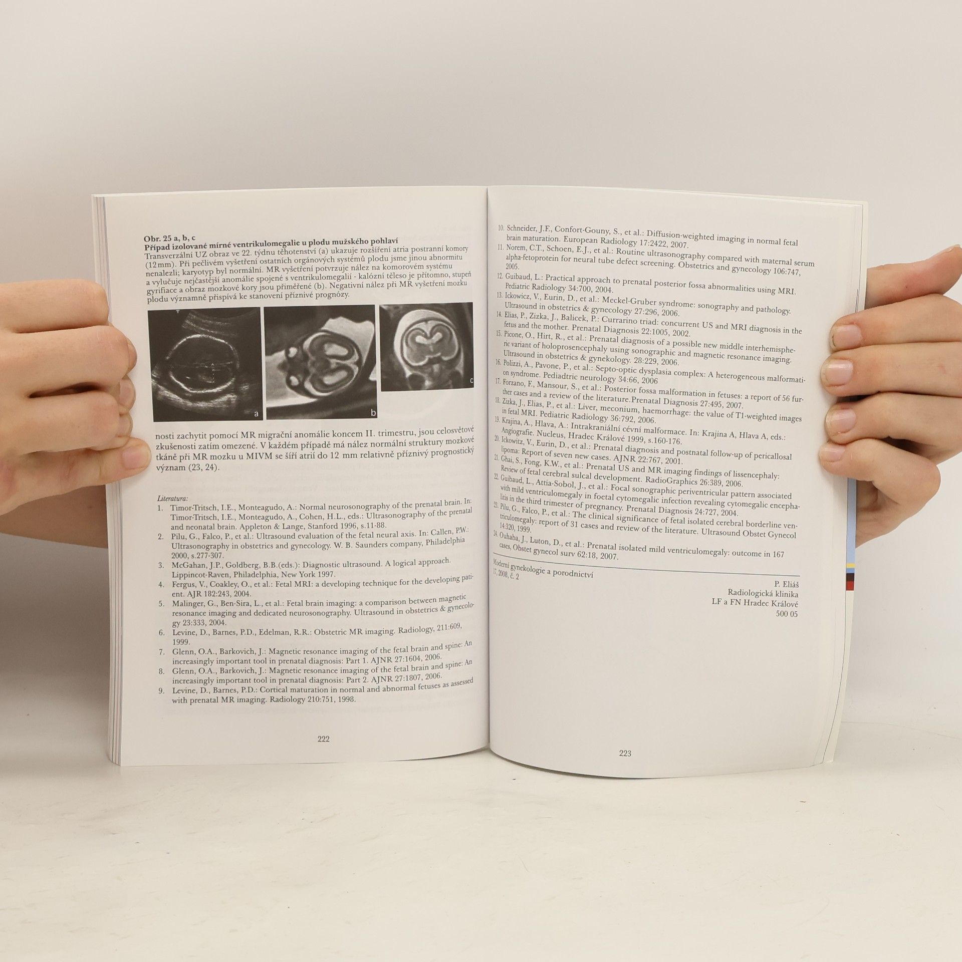 Pavel Calda Prenatální ultrazvuková diagnostika I.