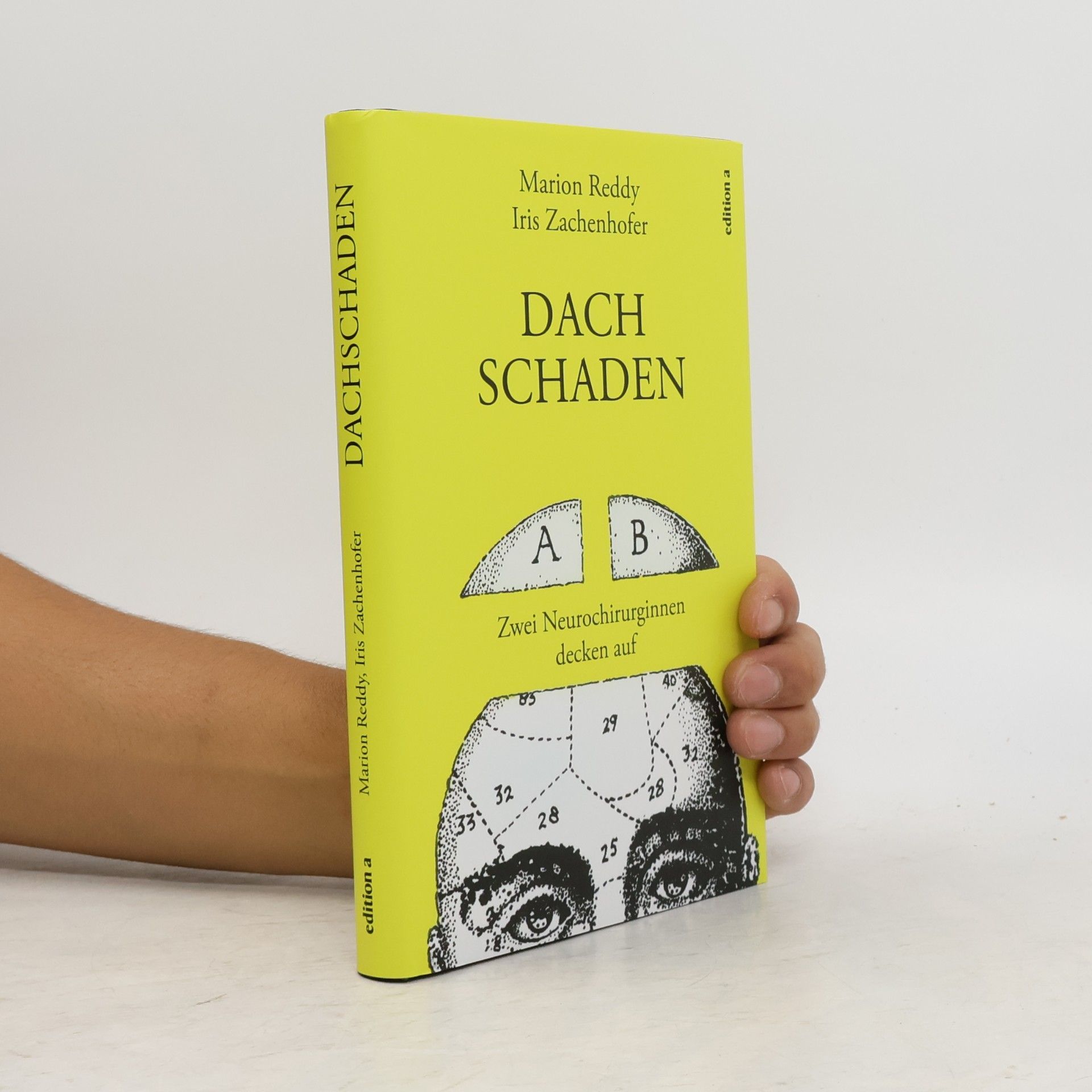 Marion Reddy Dachschaden