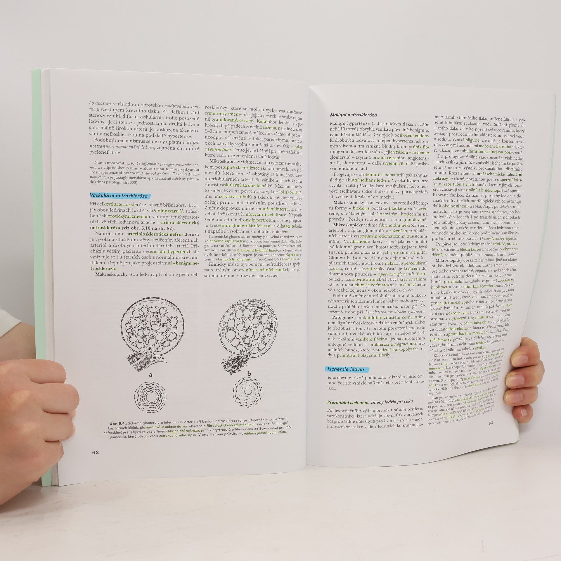 Autorenkollektiv Speciální patologie II.díl