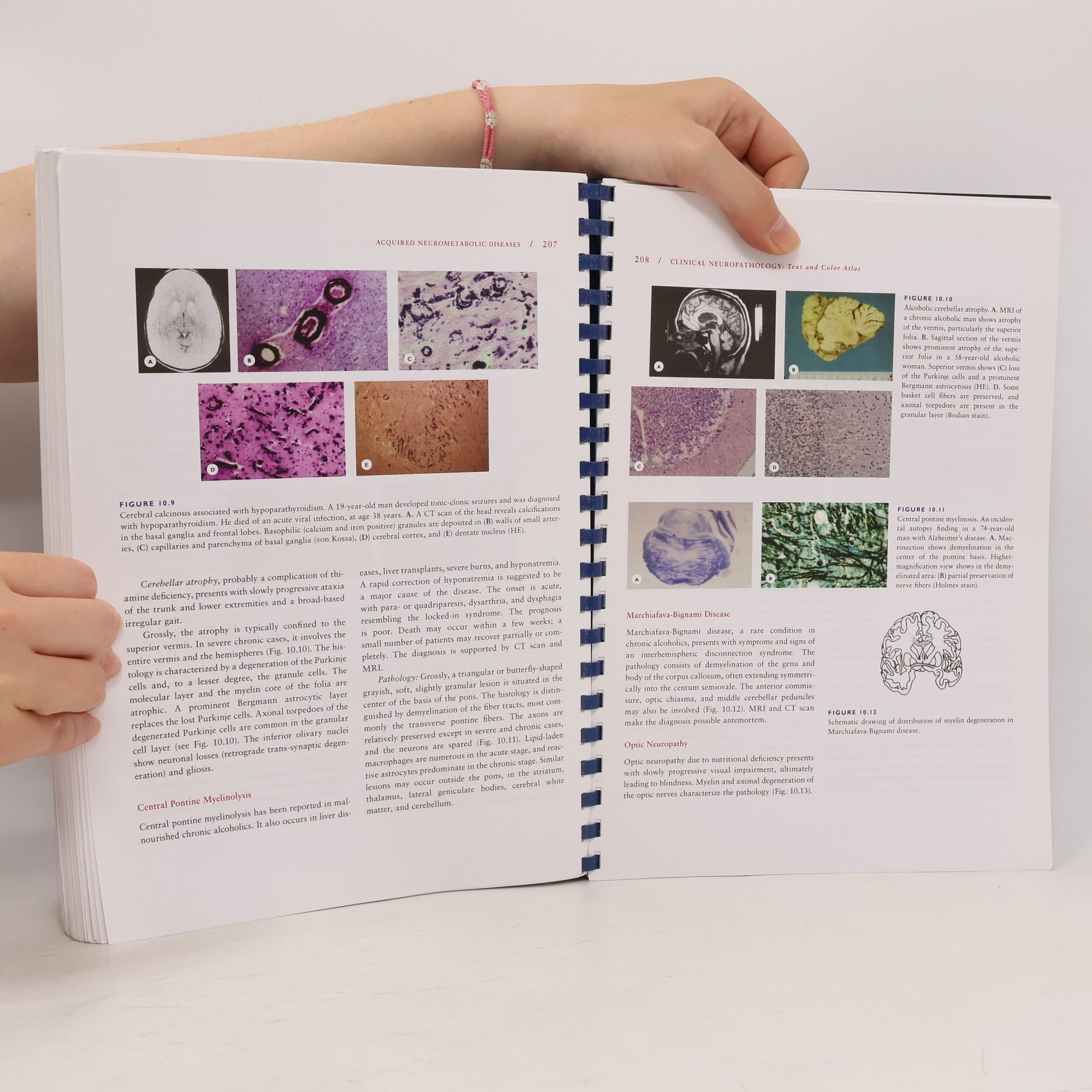 Catherine Haberland Clinical Neuropathology