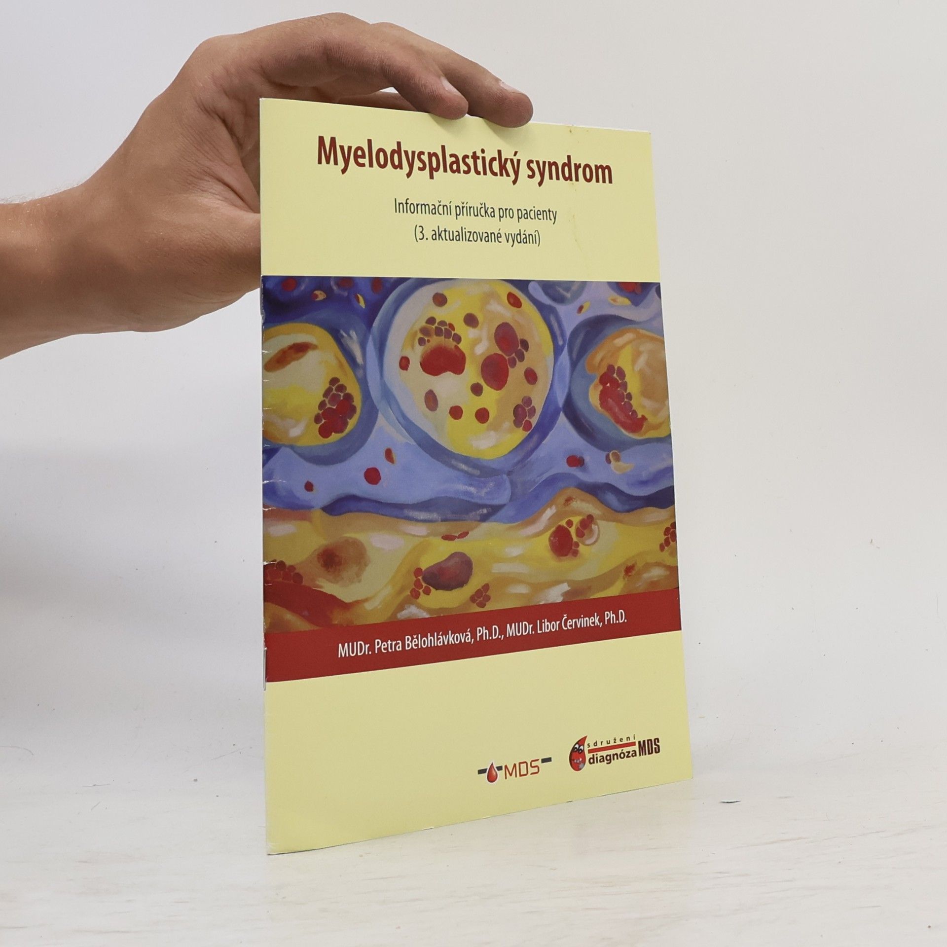 Myelodysplastický syndrom