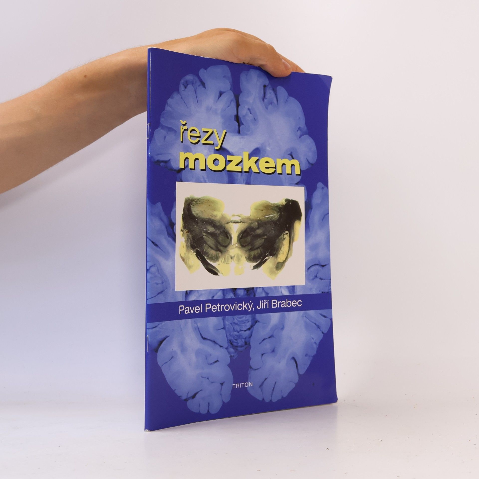 Řezy mozkem