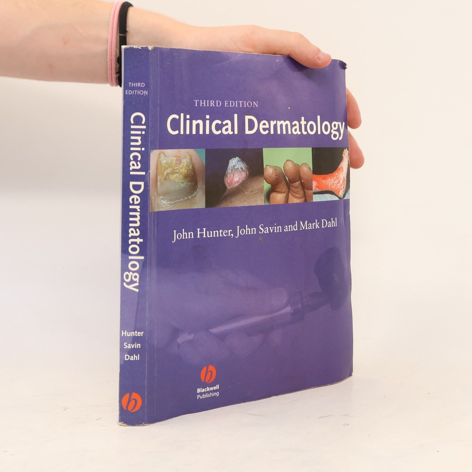 Mark V. Dahl Clinical Dermatology
