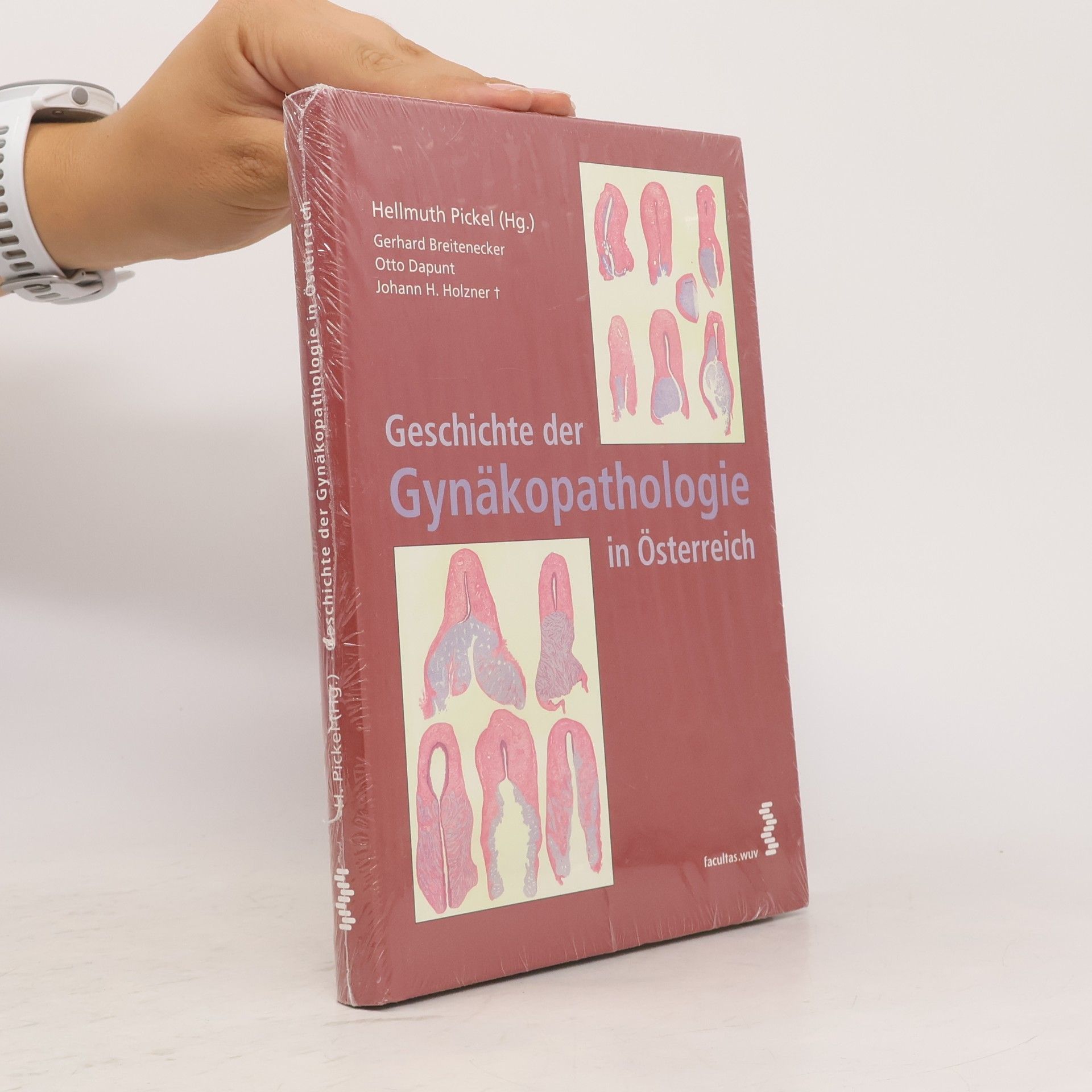 Geschichte der Gynäkopathologie in Österreich