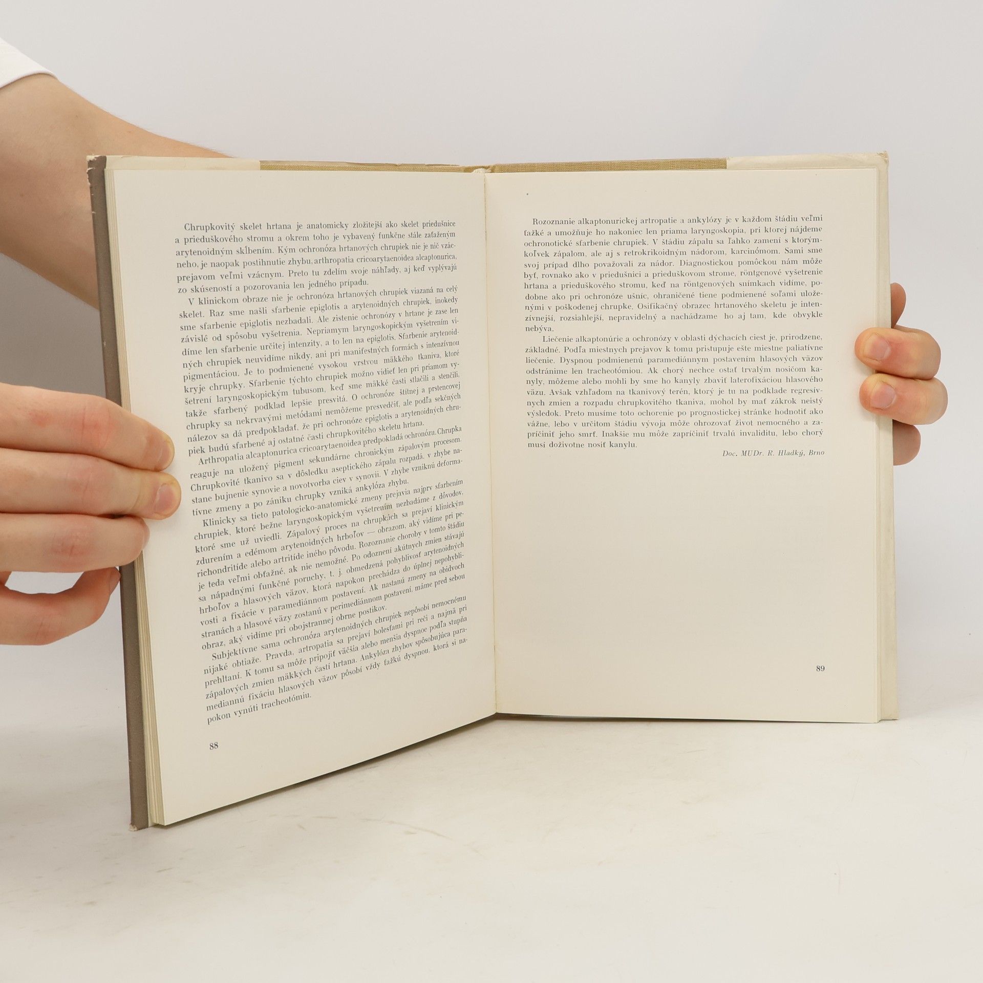 Autorenkollektiv Alkaptonúria a ochronóza