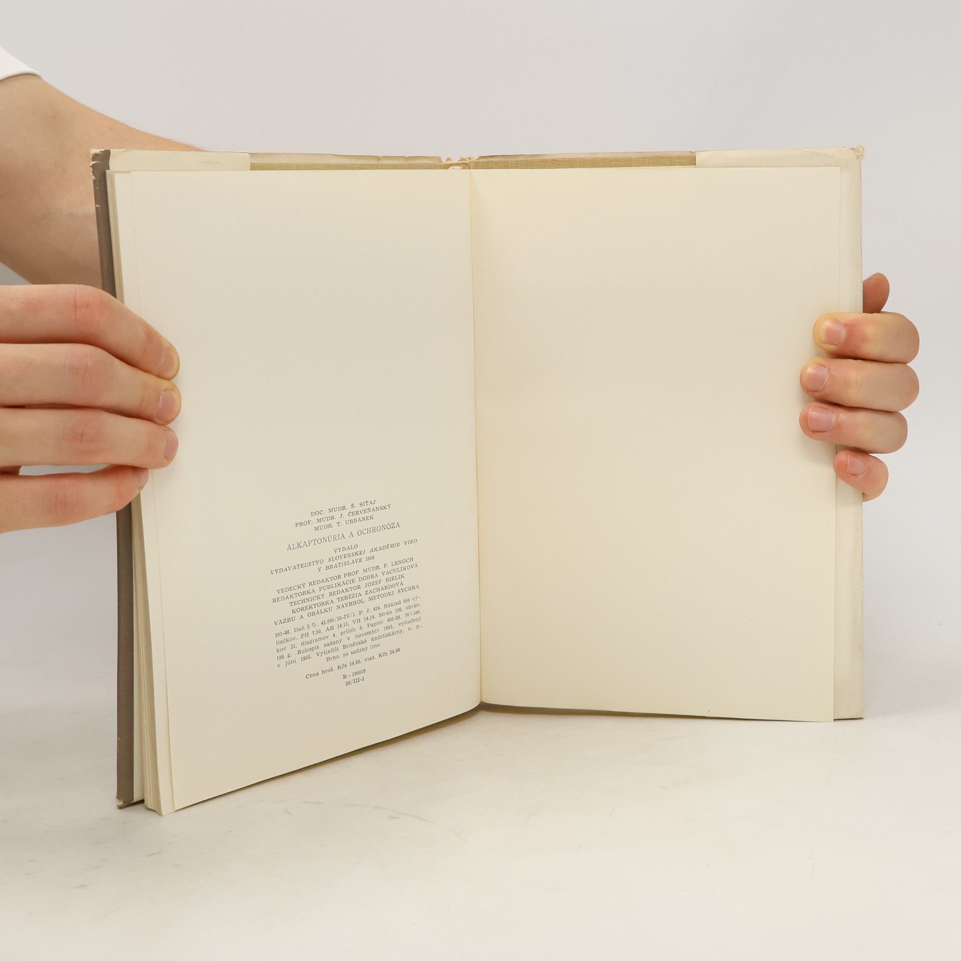 Autorenkollektiv Alkaptonúria a ochronóza