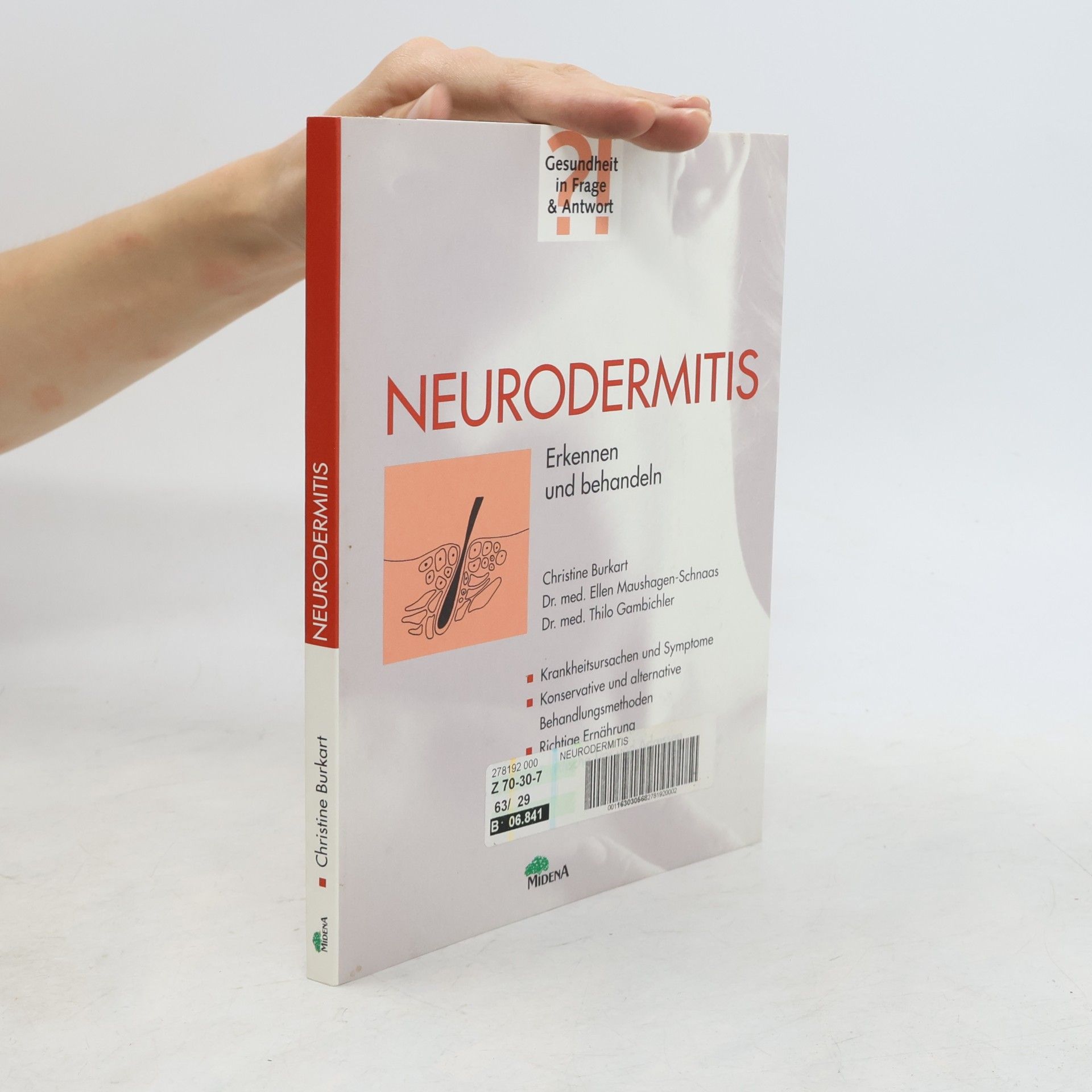 Christine Burkart Neurodermitis