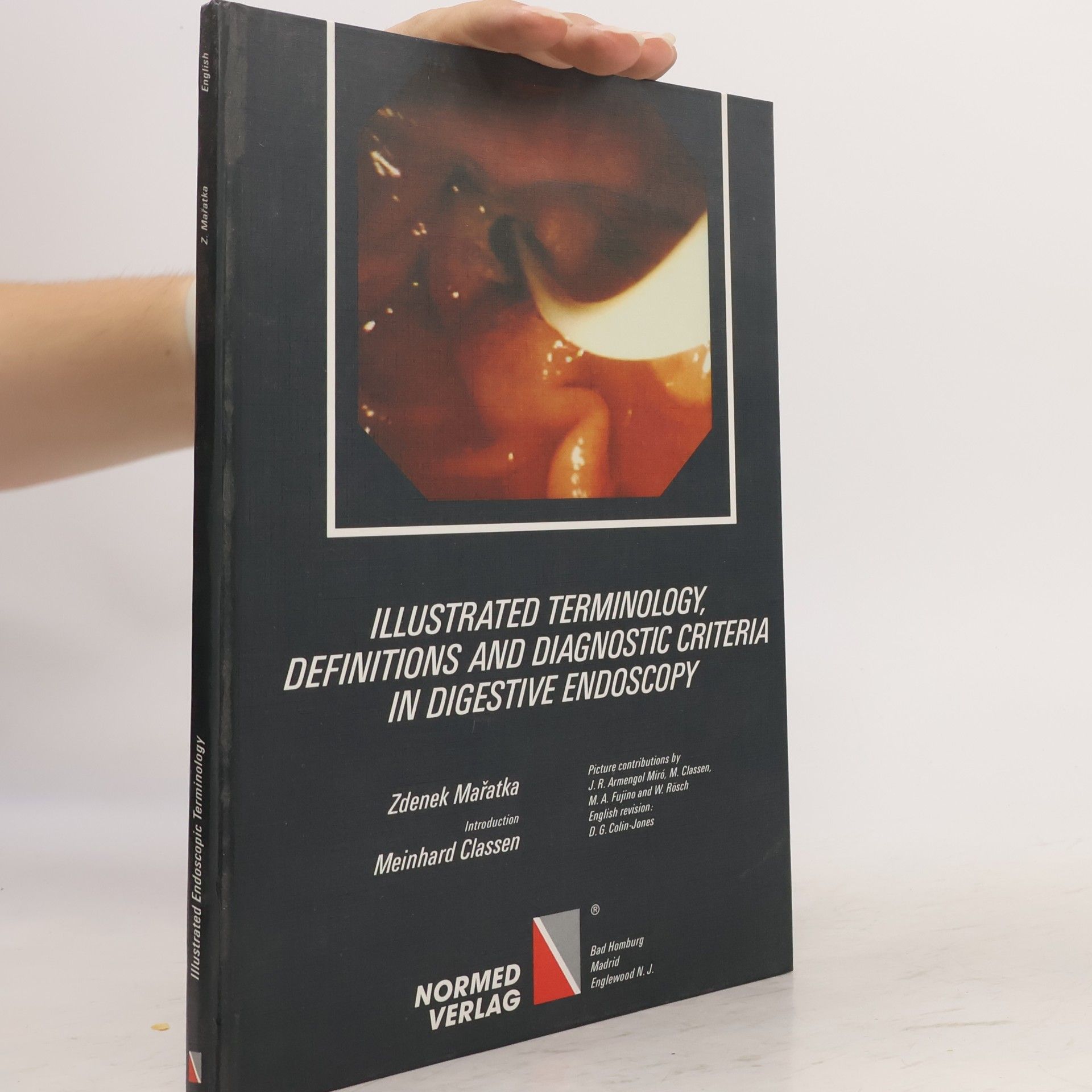 Illustrated Terminology, Definitions and Diagnostic Criteria in Digestive Endoscopy