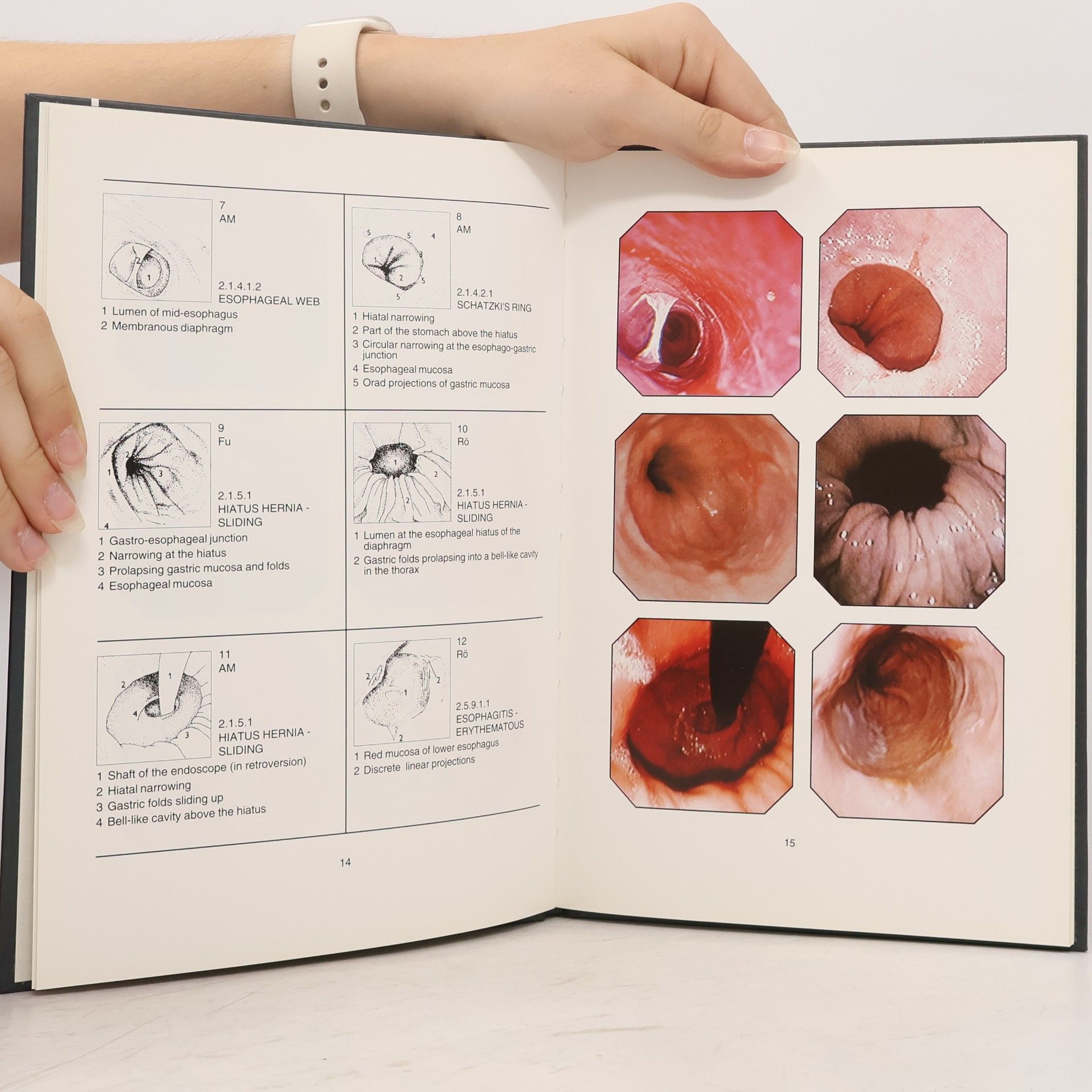 Z. Maratka Illustrated Terminology, Definitions and Diagnostic Criteria in Digestive Endoscopy