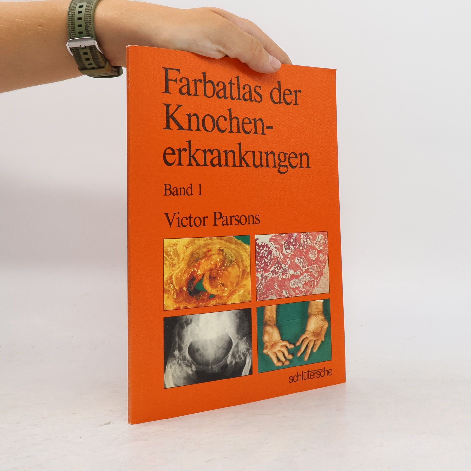 Victor Parsons Farbatlas der Knochenerkrankungen 1-2