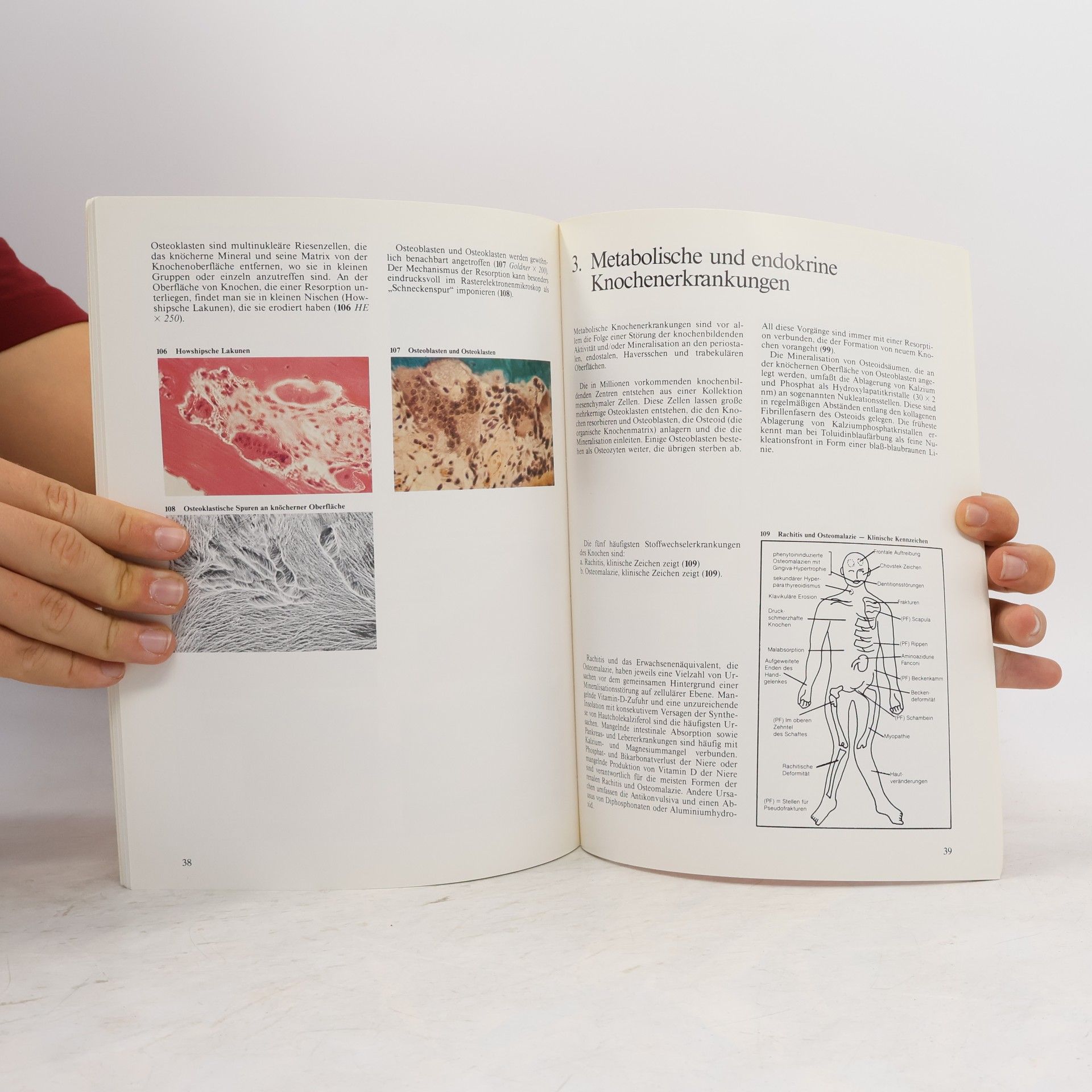 Victor Parsons Farbatlas der Knochenerkrankungen 1-2