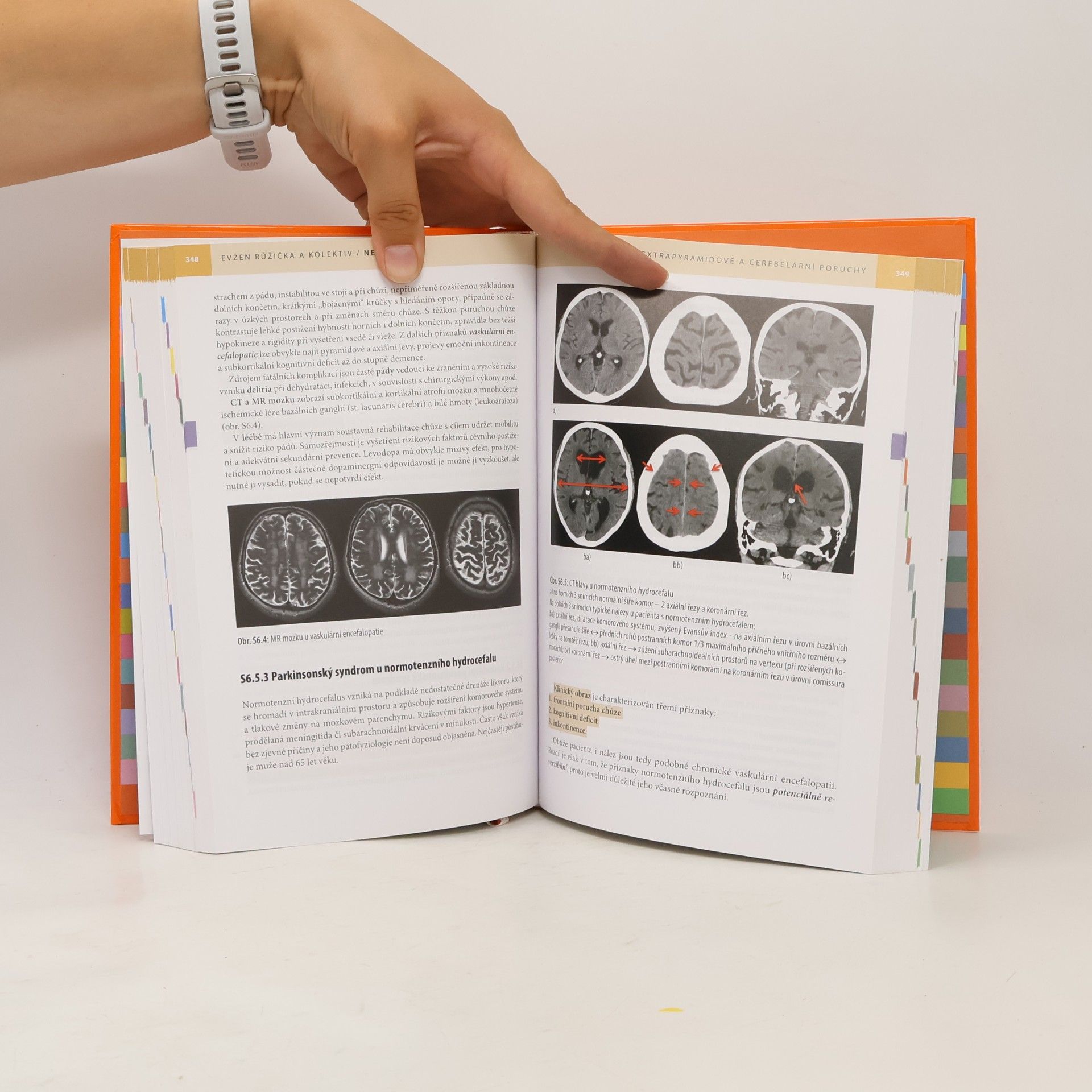 Evžen Růžička Neurologie