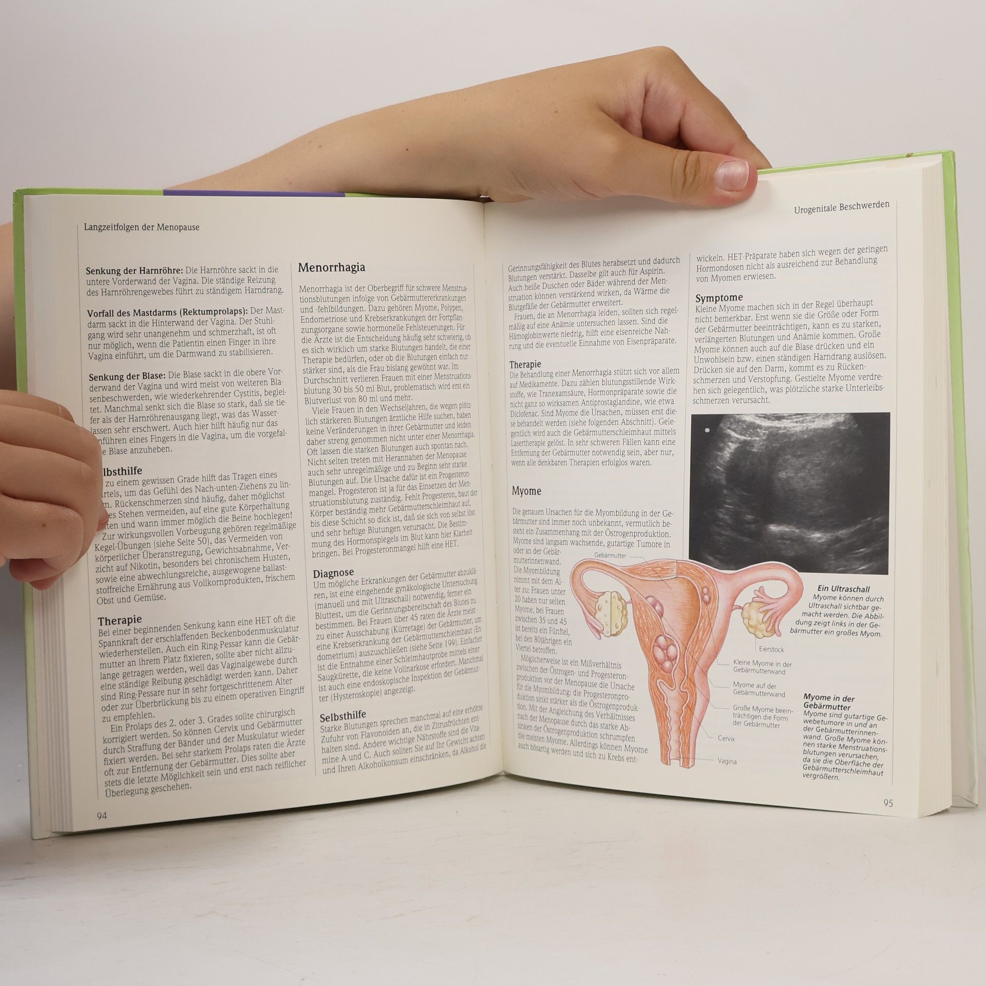 Miriam Stoppardová Menopause