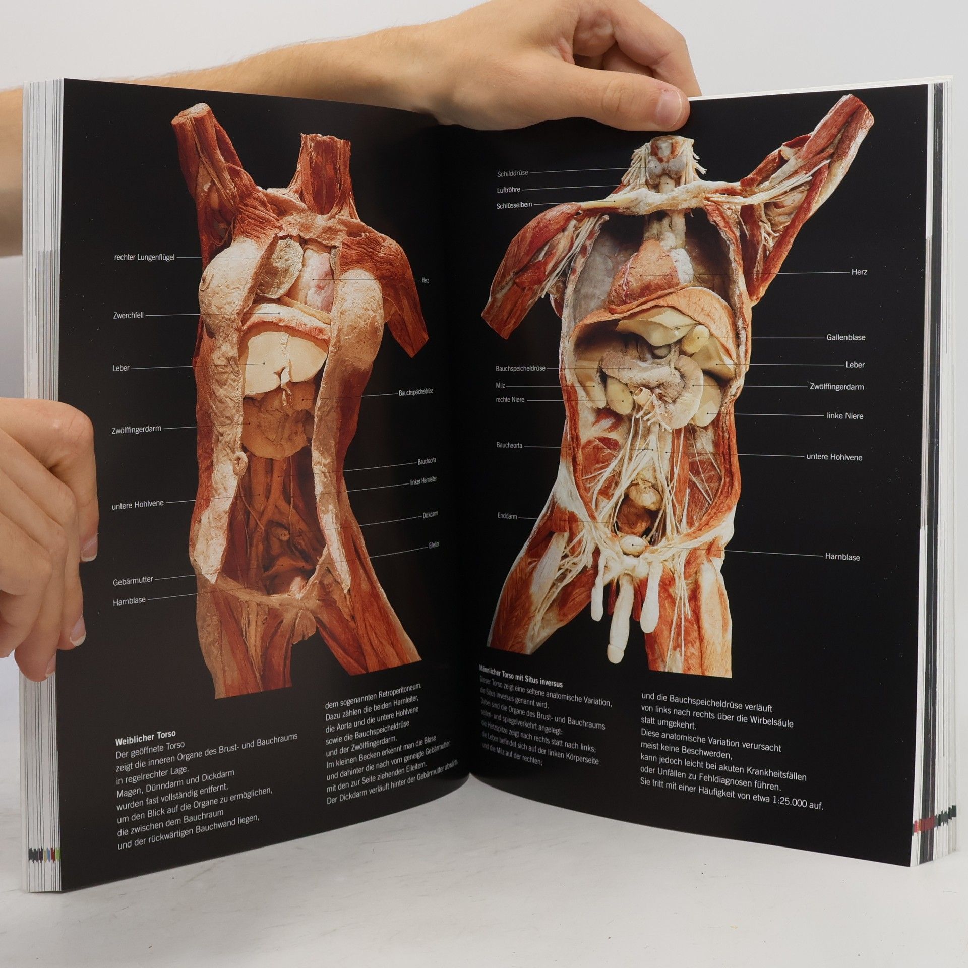Guther von Hagens Gunther von Hagens' Körperwelten