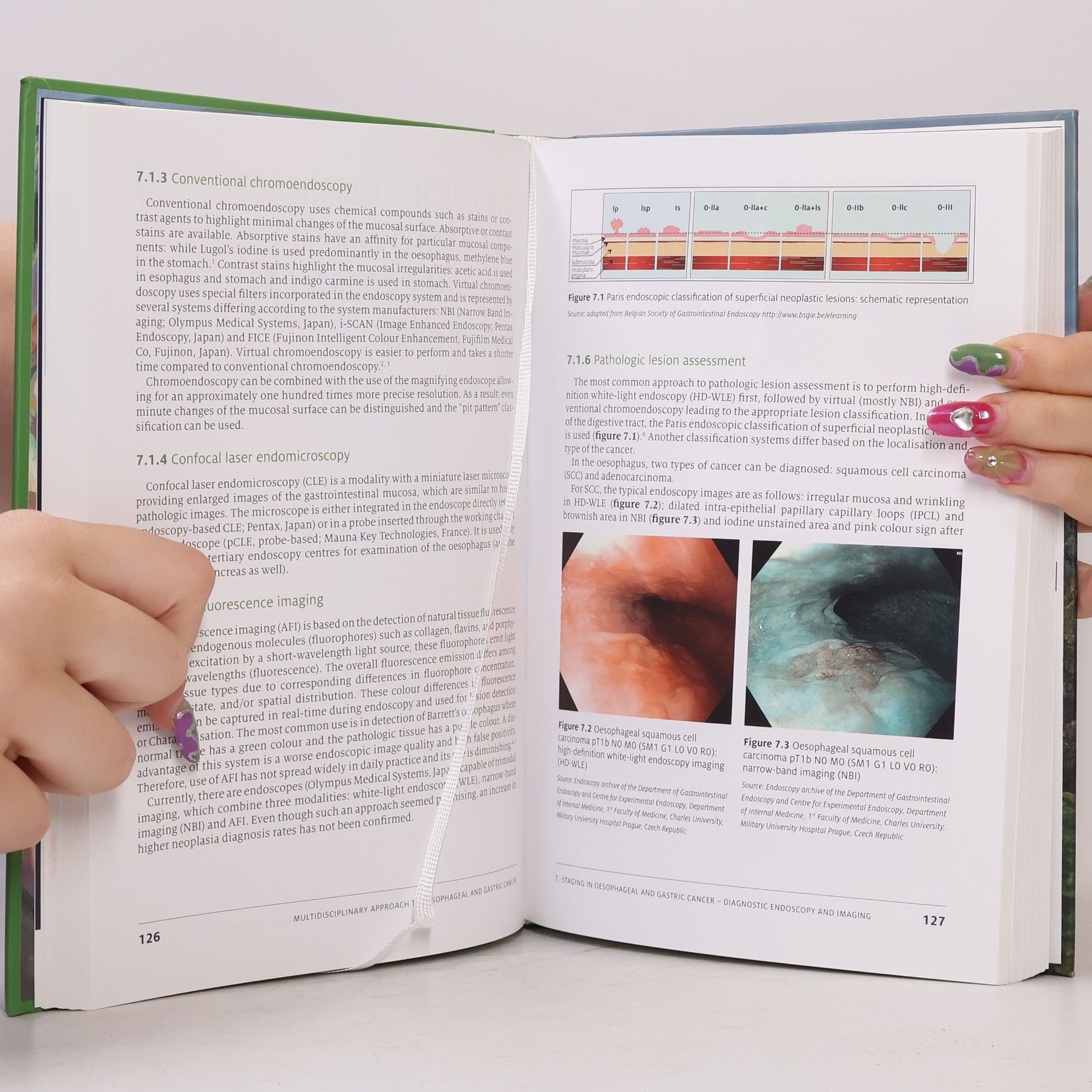 Radka Obermannová Multidisciplinary approach to oesophageal and gastric cancer