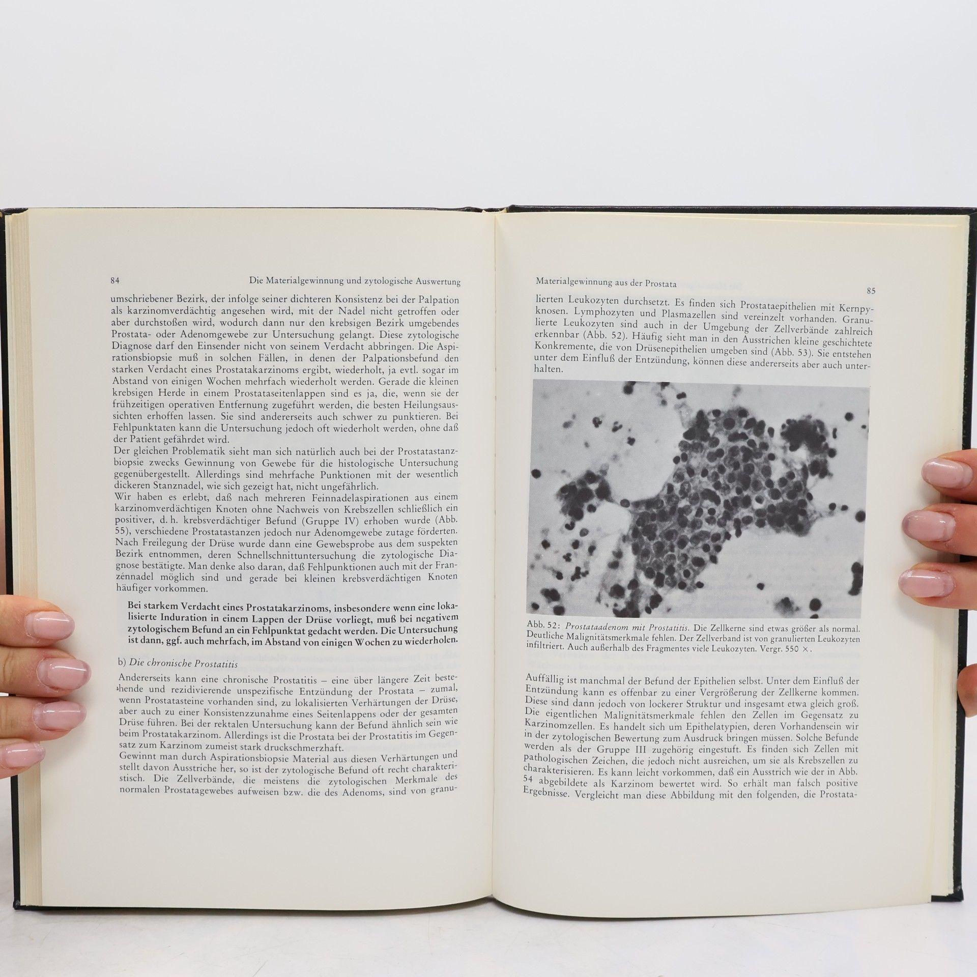 Bodo Riedel Urologische Zytologie