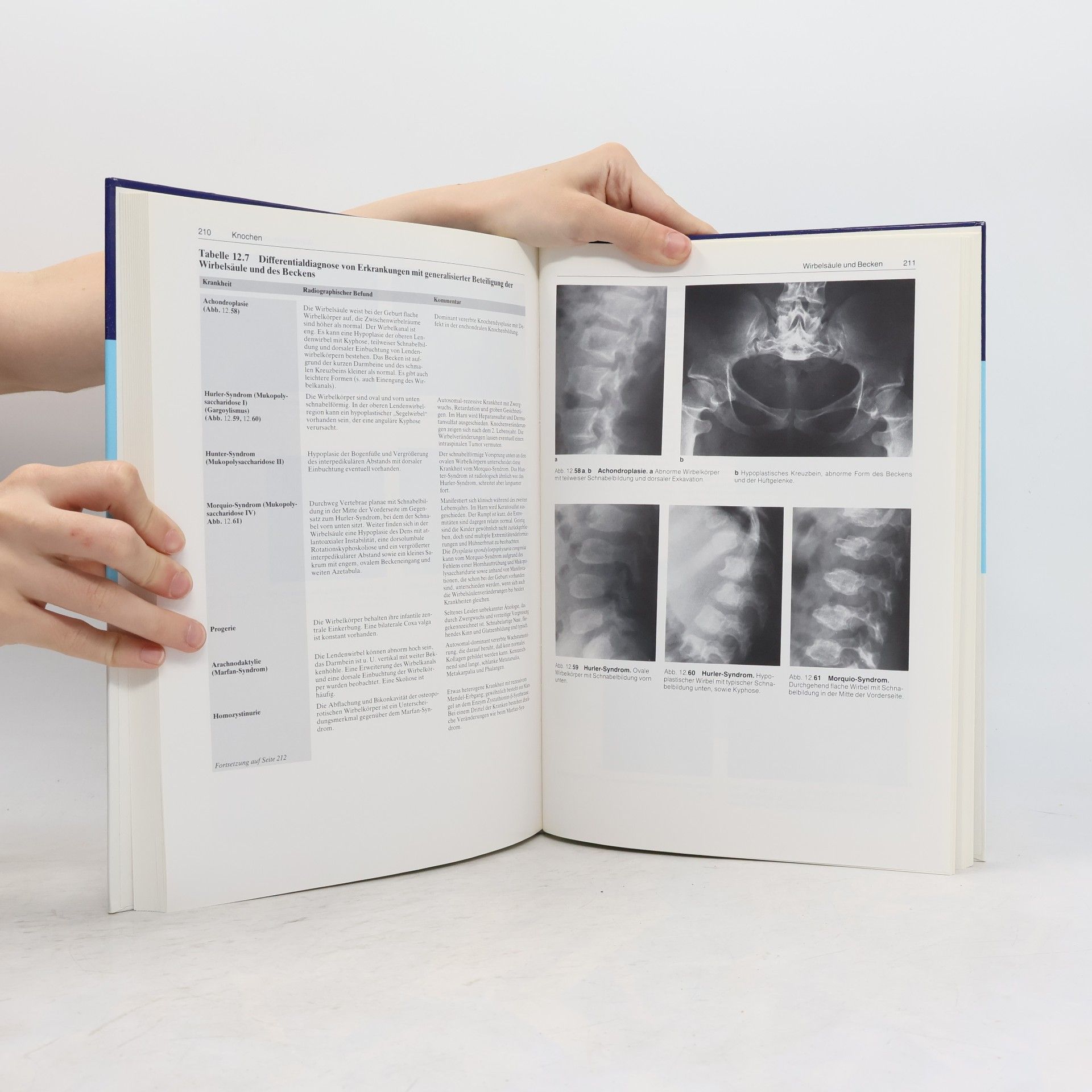 Francis A. Burgener Radiologische Differentialdiagnostik in Orthopädie und Rheumatologie