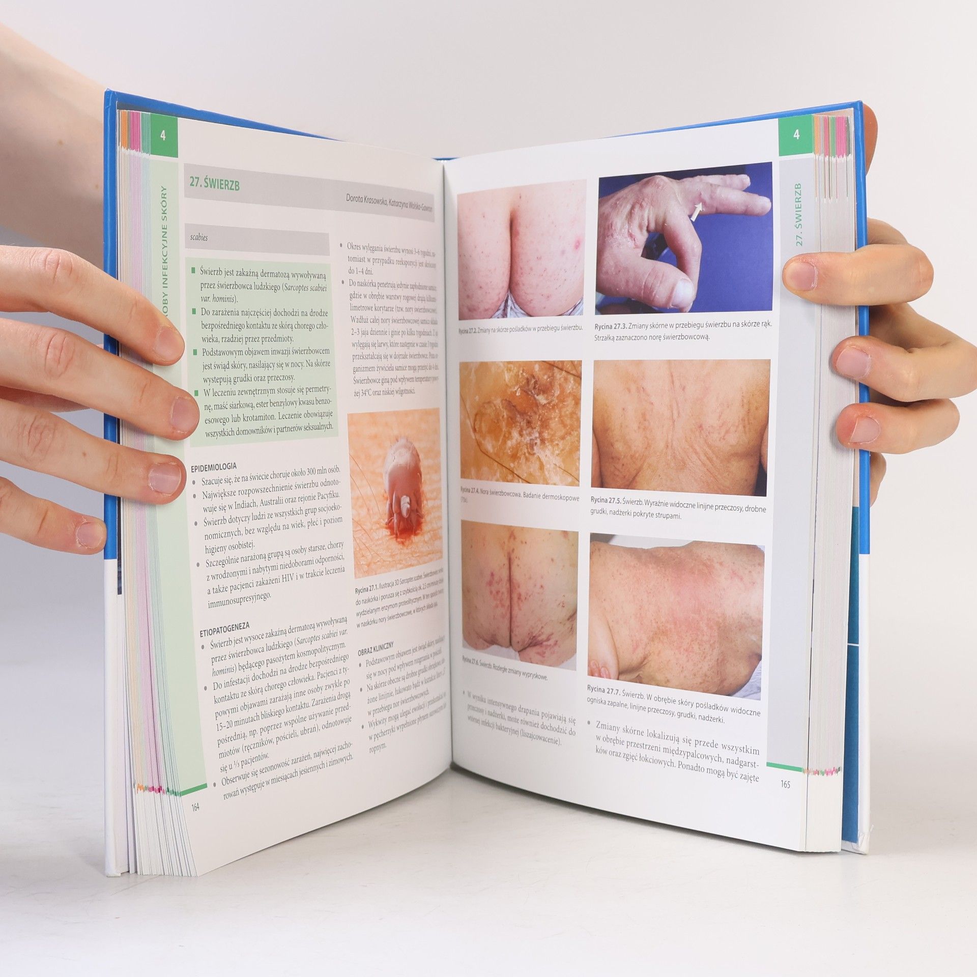 Olszewska, Małgorzata Współczesna dermatologia Tom 1