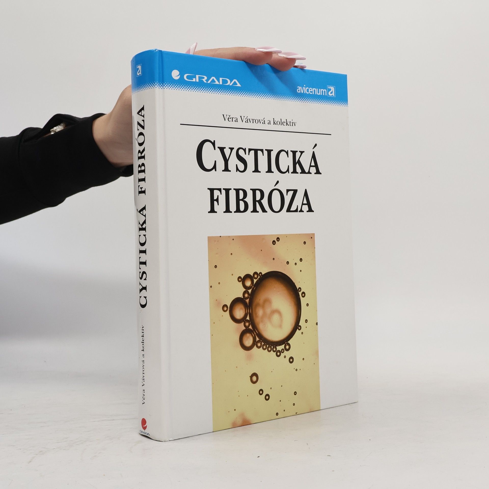 Věra Vávrová Cystická fibróza
