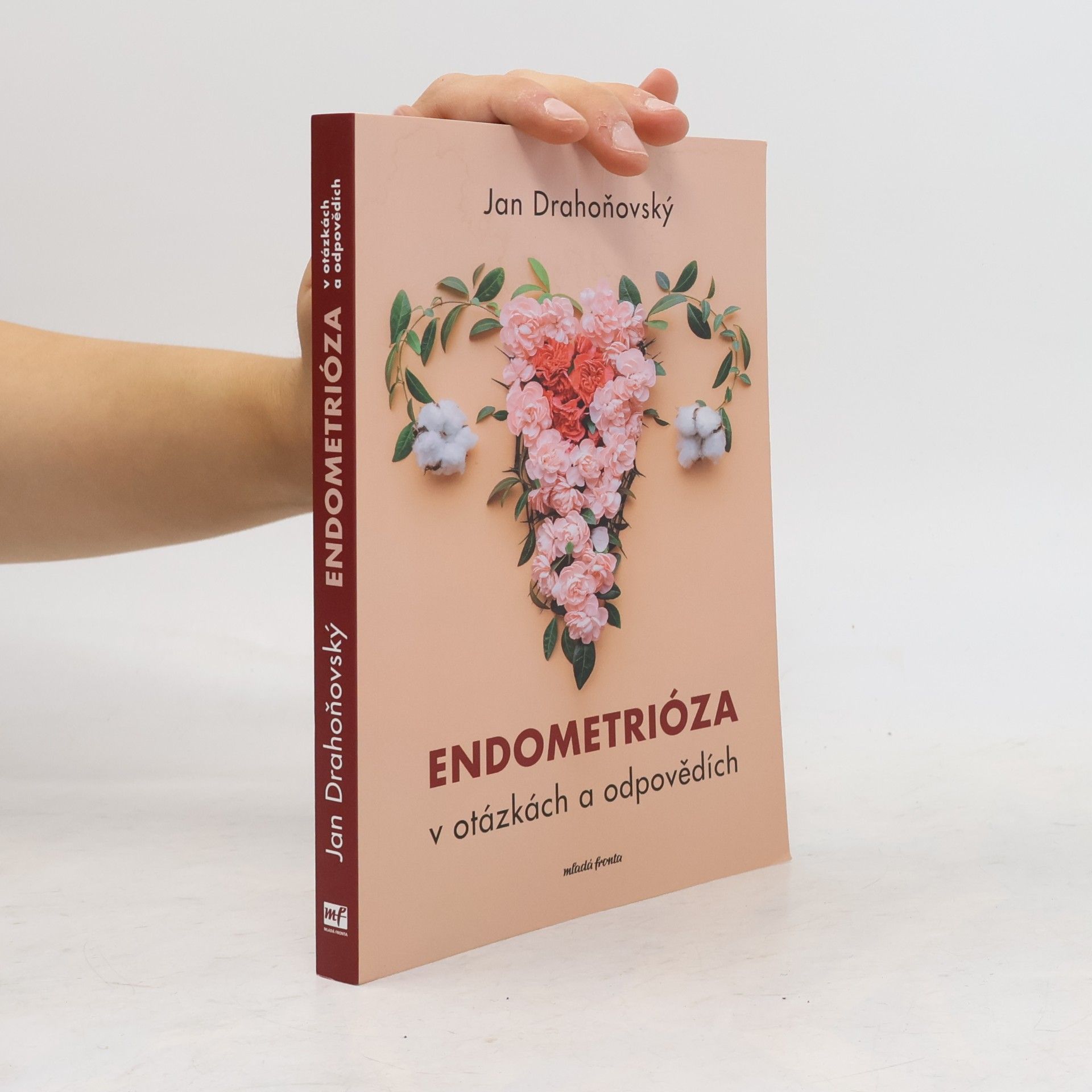 Jan Drahoňovský Endometrióza v otázkách a odpovědích