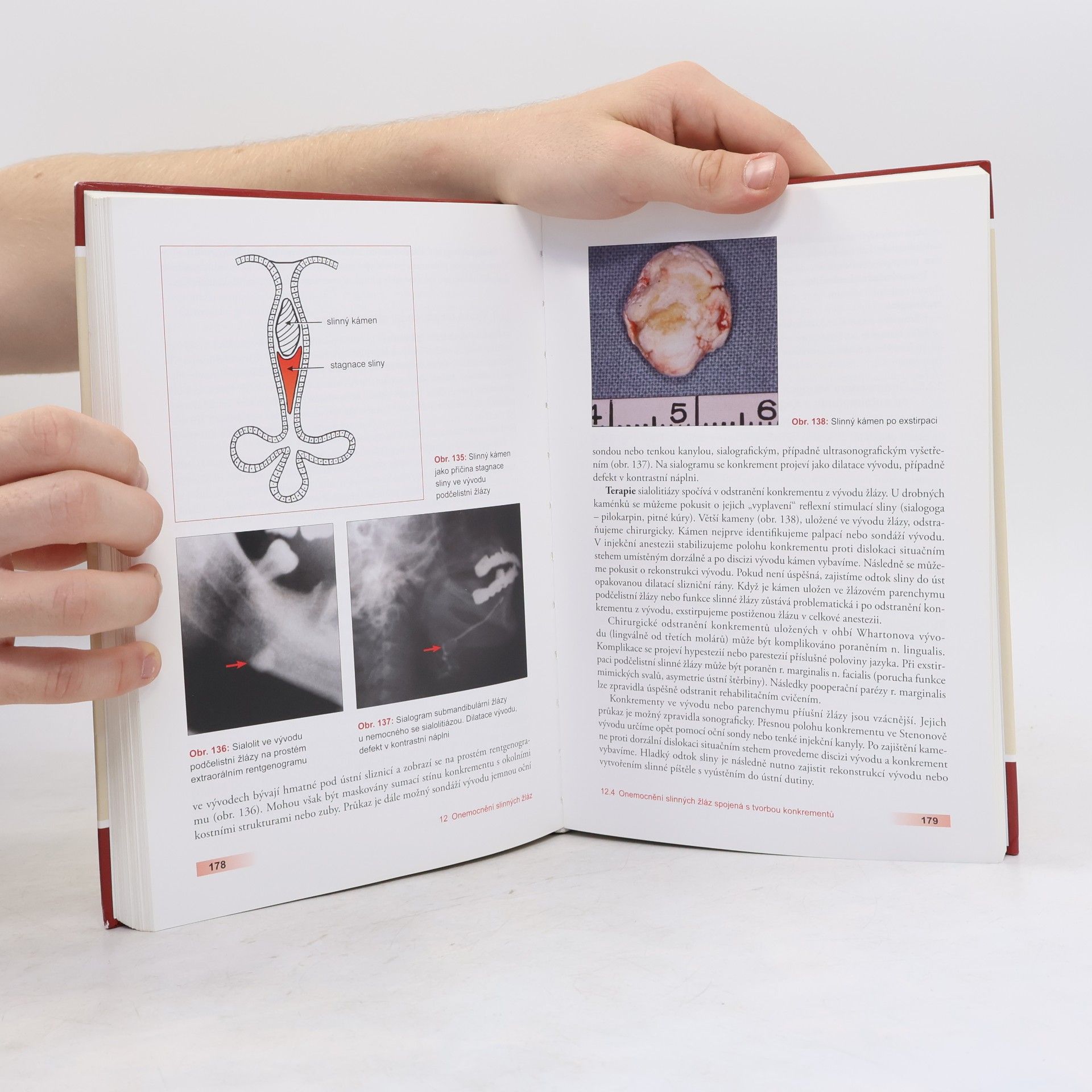 Jindřich Pazdera Základy ústní a čelistní chirurgie