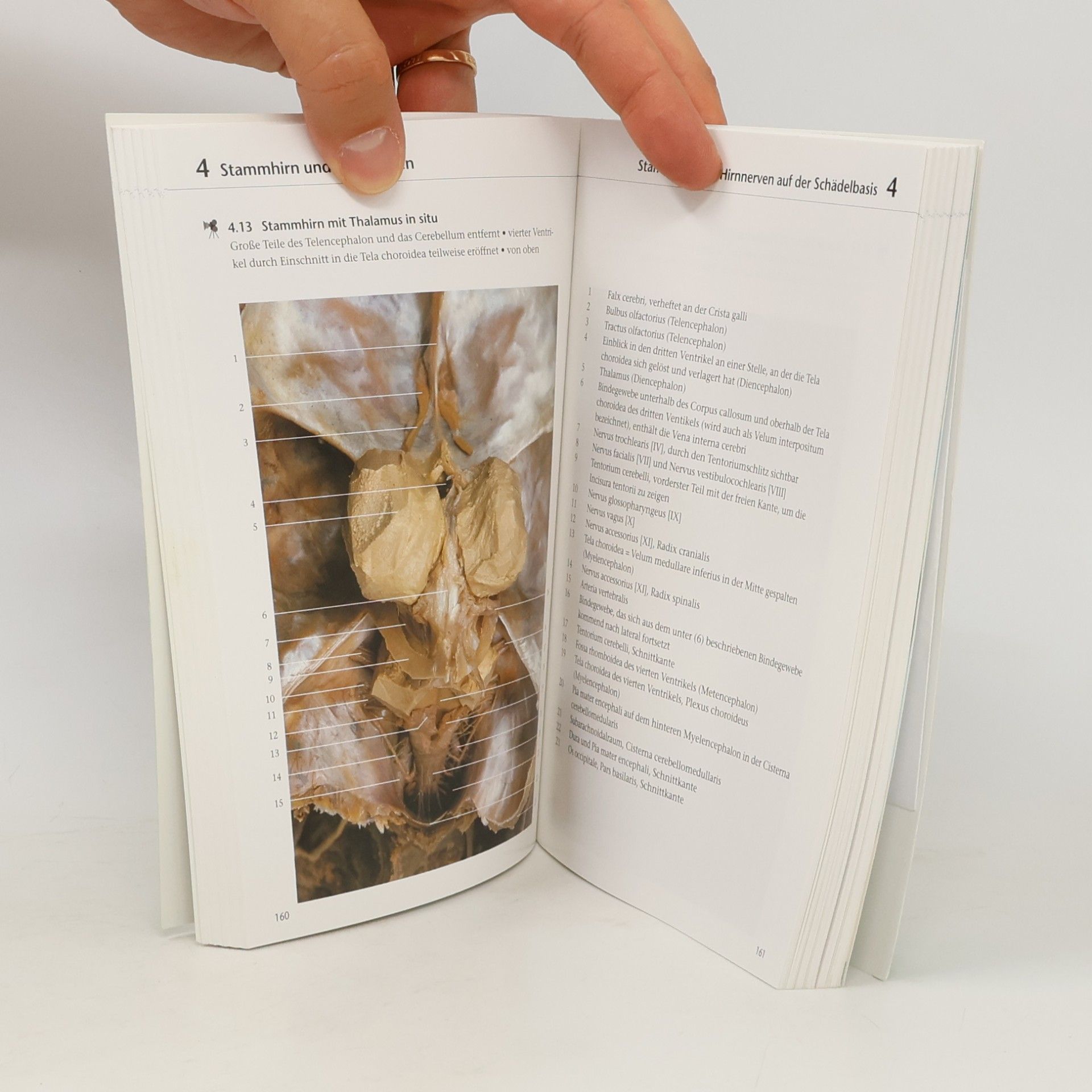 Klaus Peter Valerius Fotoatlas Neuroanatomie