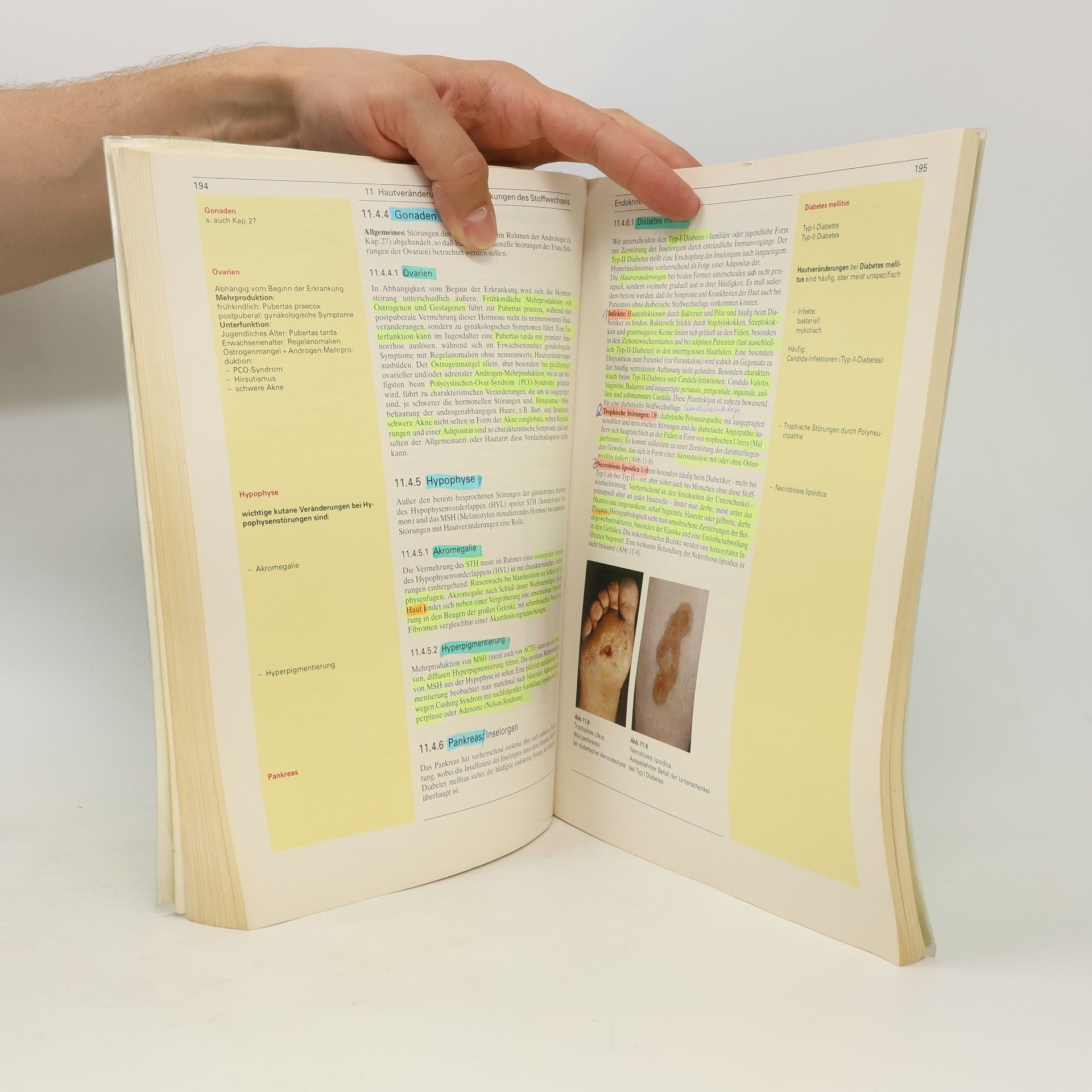 Beate Maria Henz De Gruyter Lehrbuch: Dermatologie und Venerologie mit Repetitorium