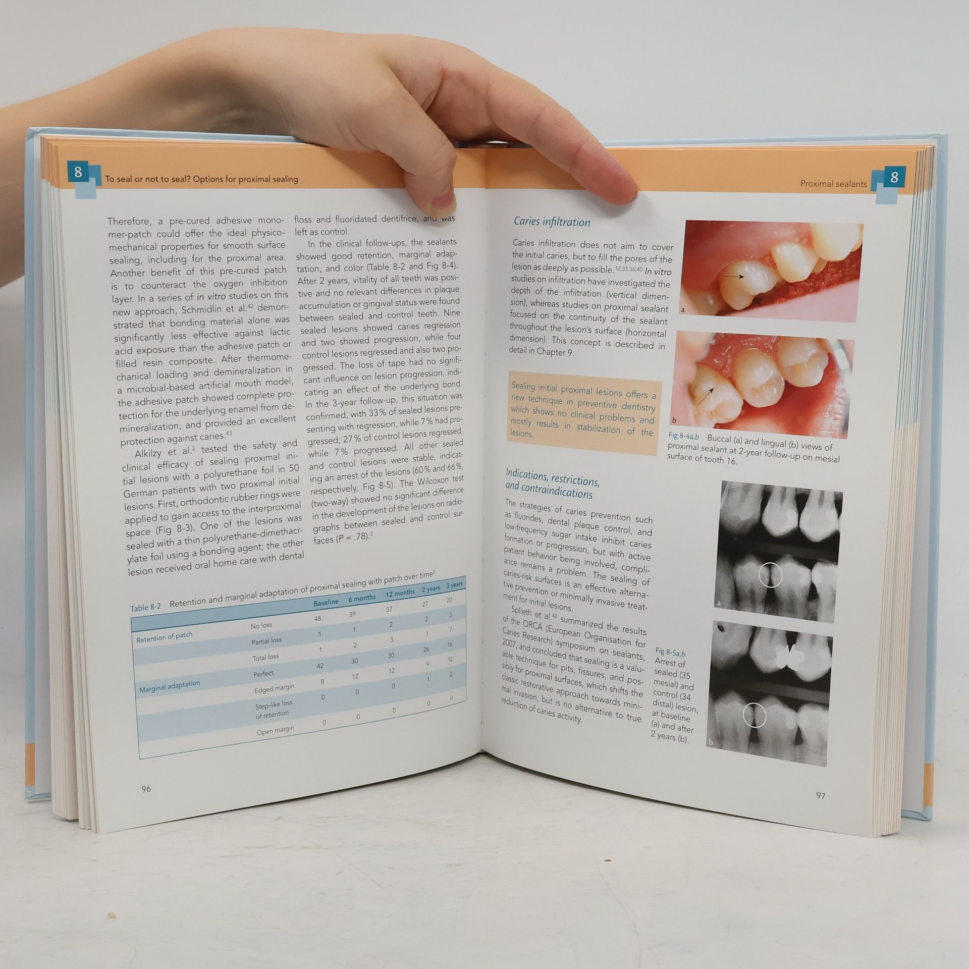 Christian H. Splieth Revolutions In Pediatric Dentistry