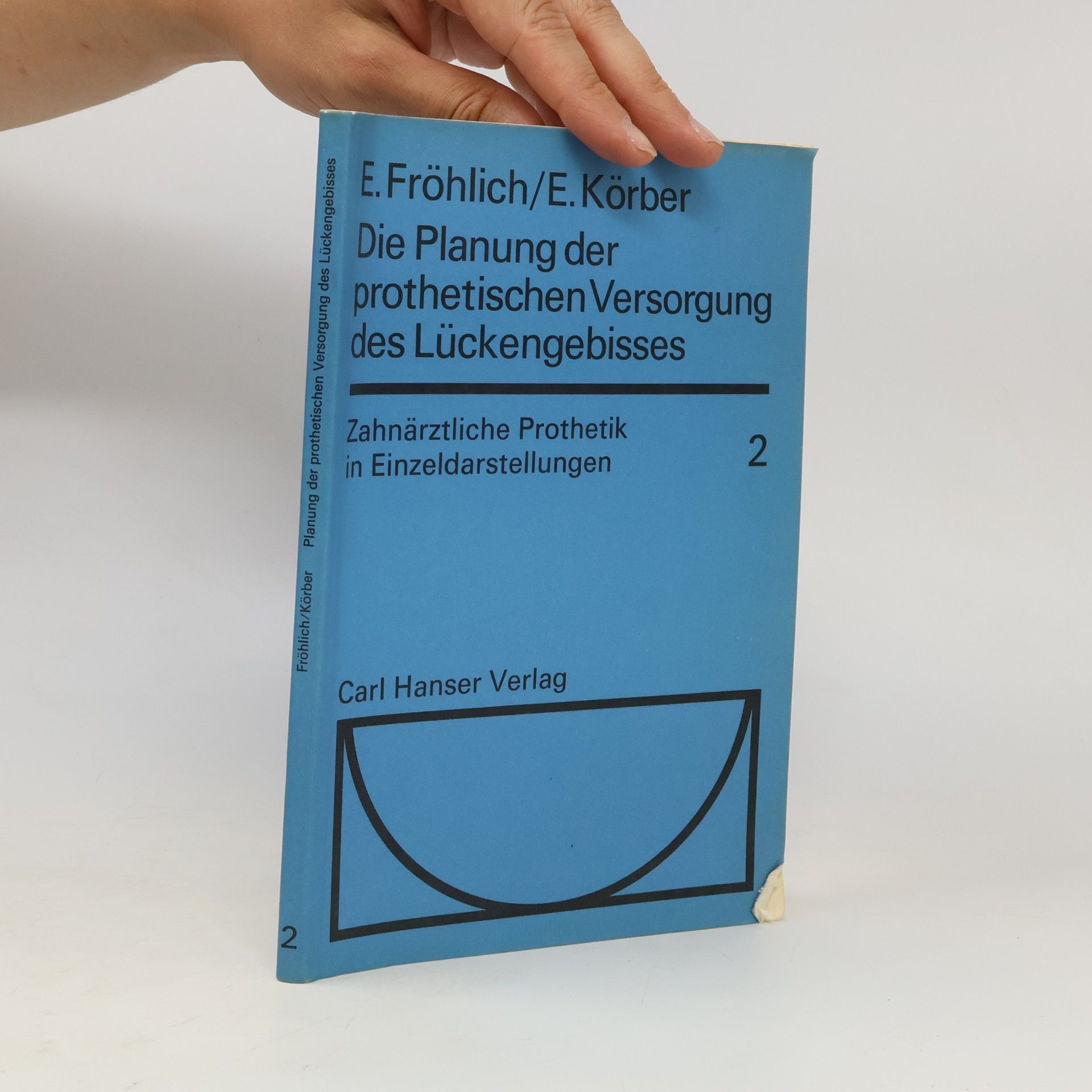 Die Planung der prothetischen Versorgung des Lückengebisses 2