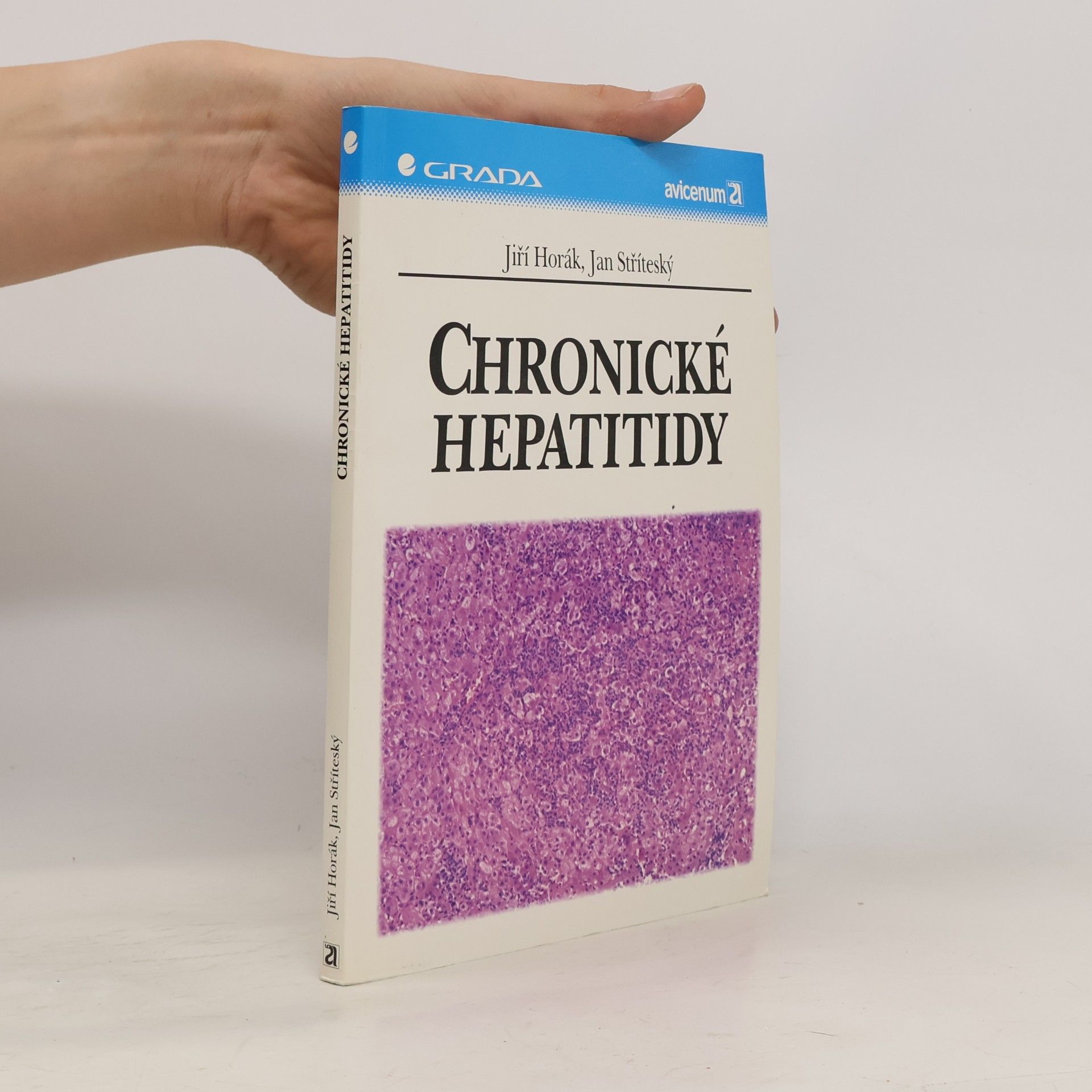 Jan Stříteský Chronické hepatitidy