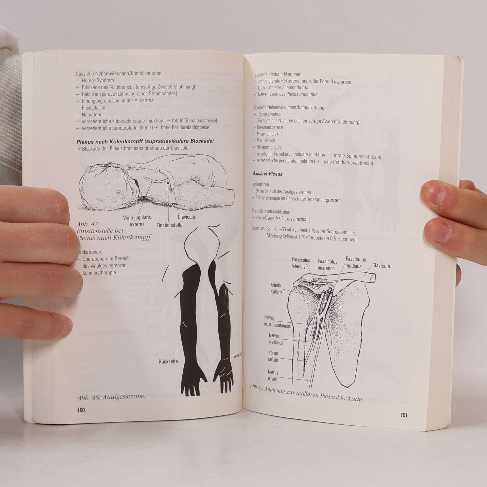 Rainer Hirt Handbuch der Anästhesie für Schwestern und Pfleger