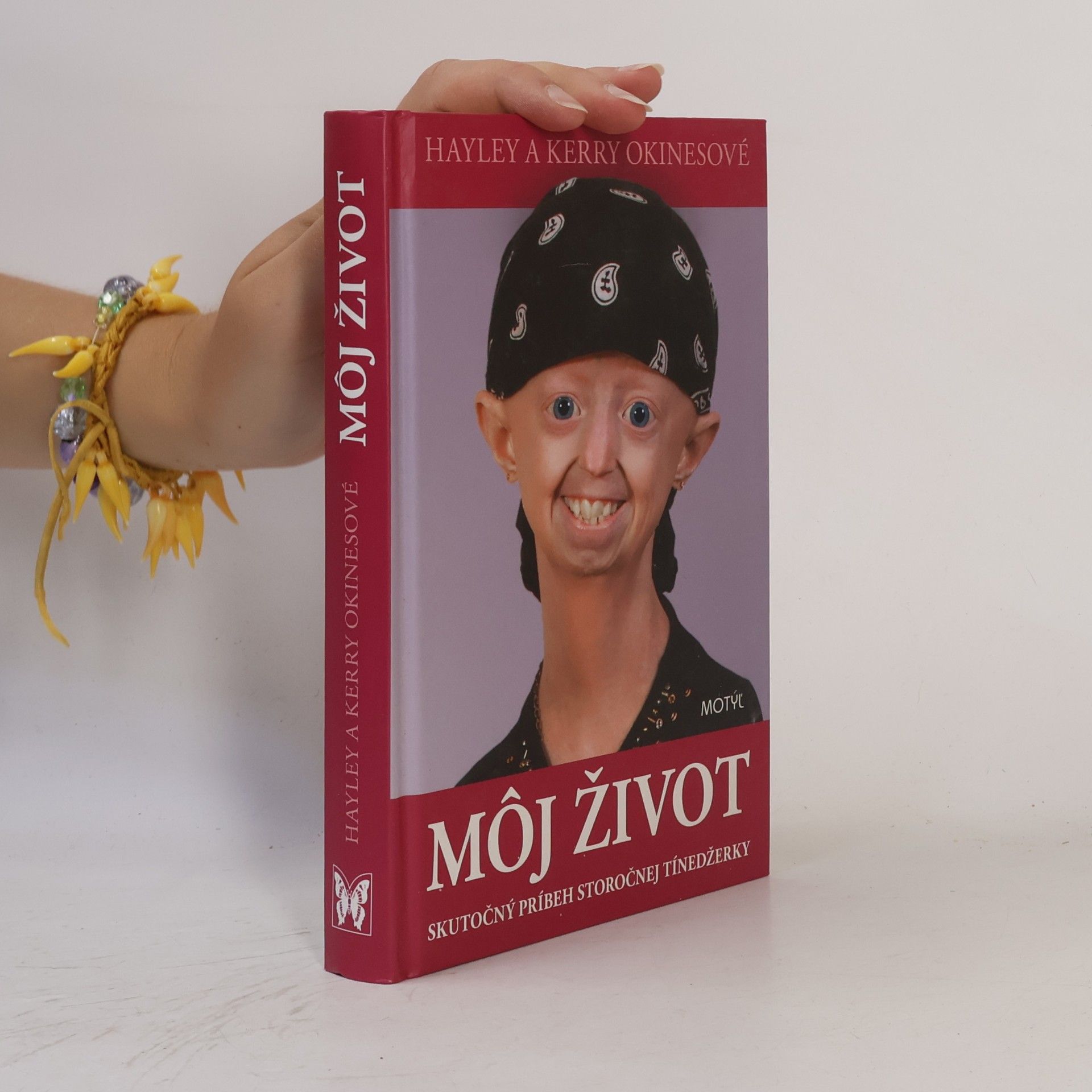 Hayley Okines Môj život