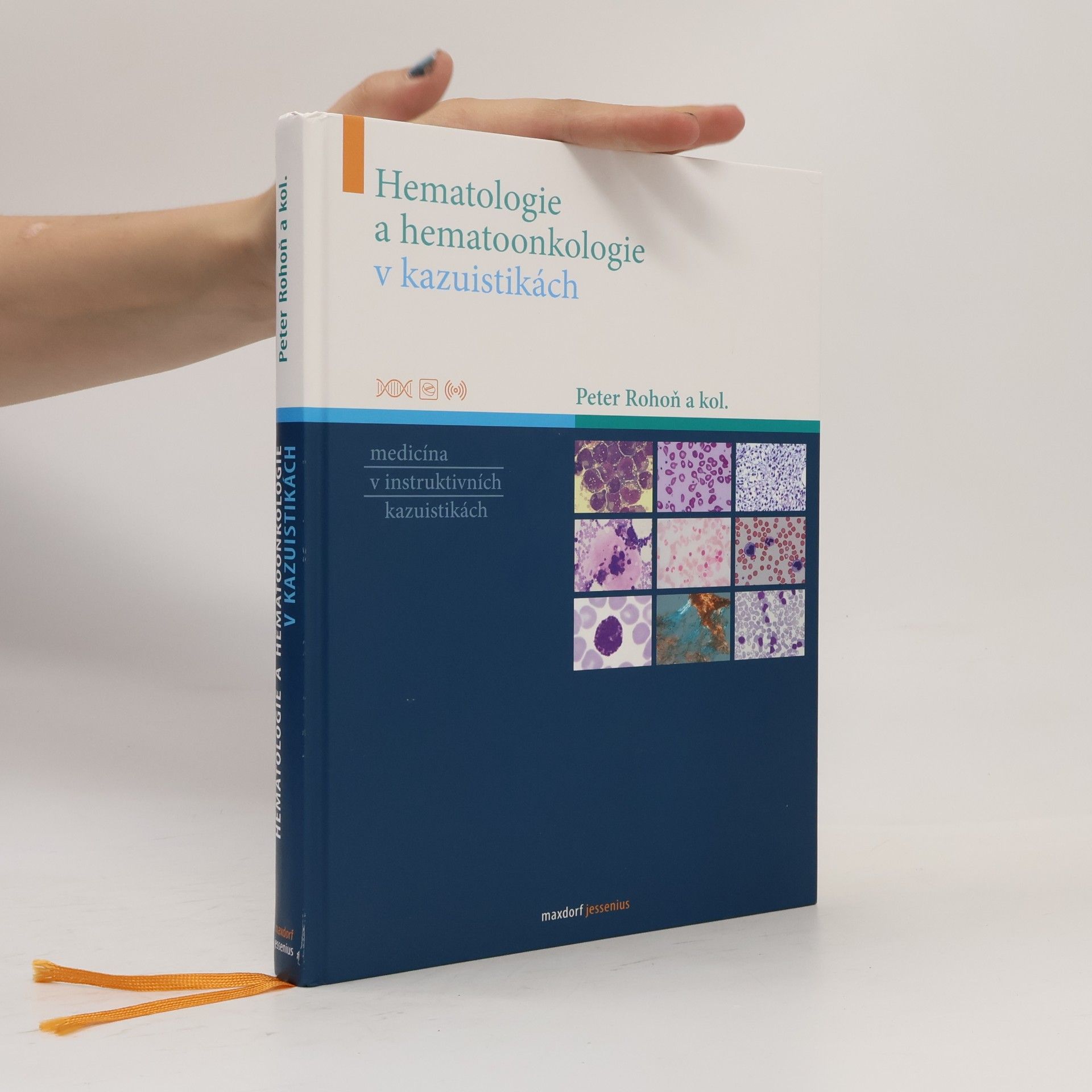 Peter Rohoň Hematologie a hematoonkologie v kazuistikách