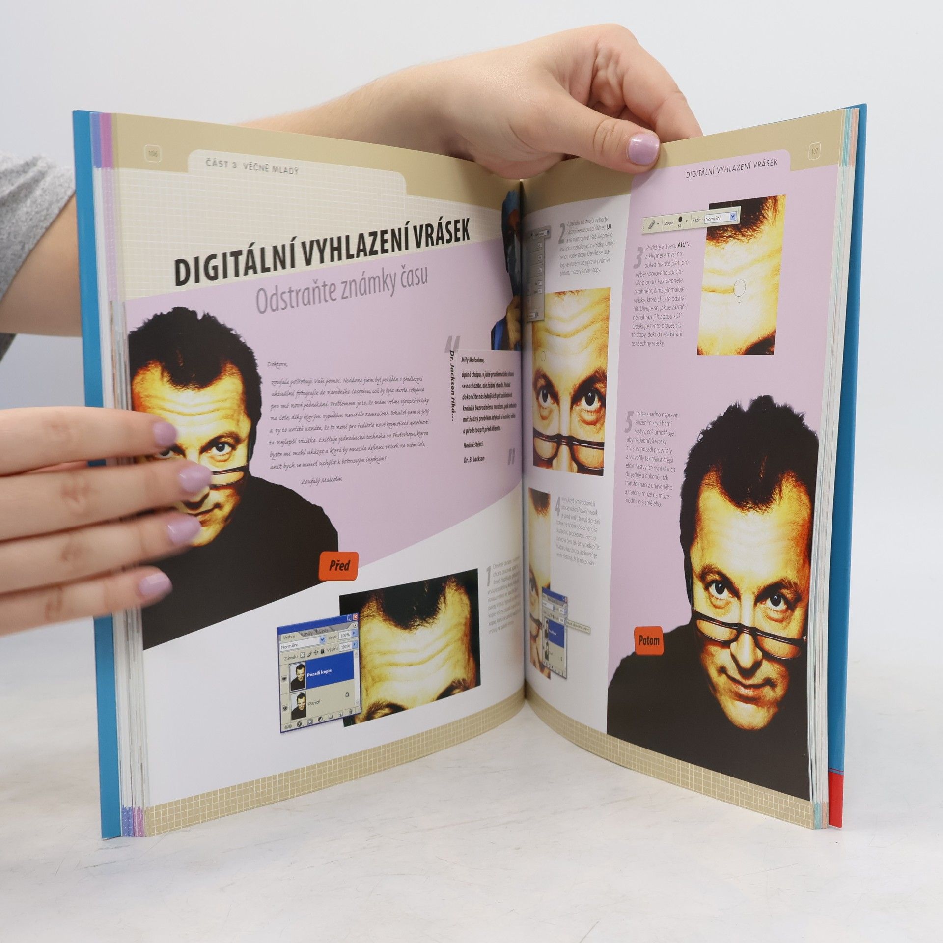 Barry Jackson Plastická chirurgie ve Photoshopu
