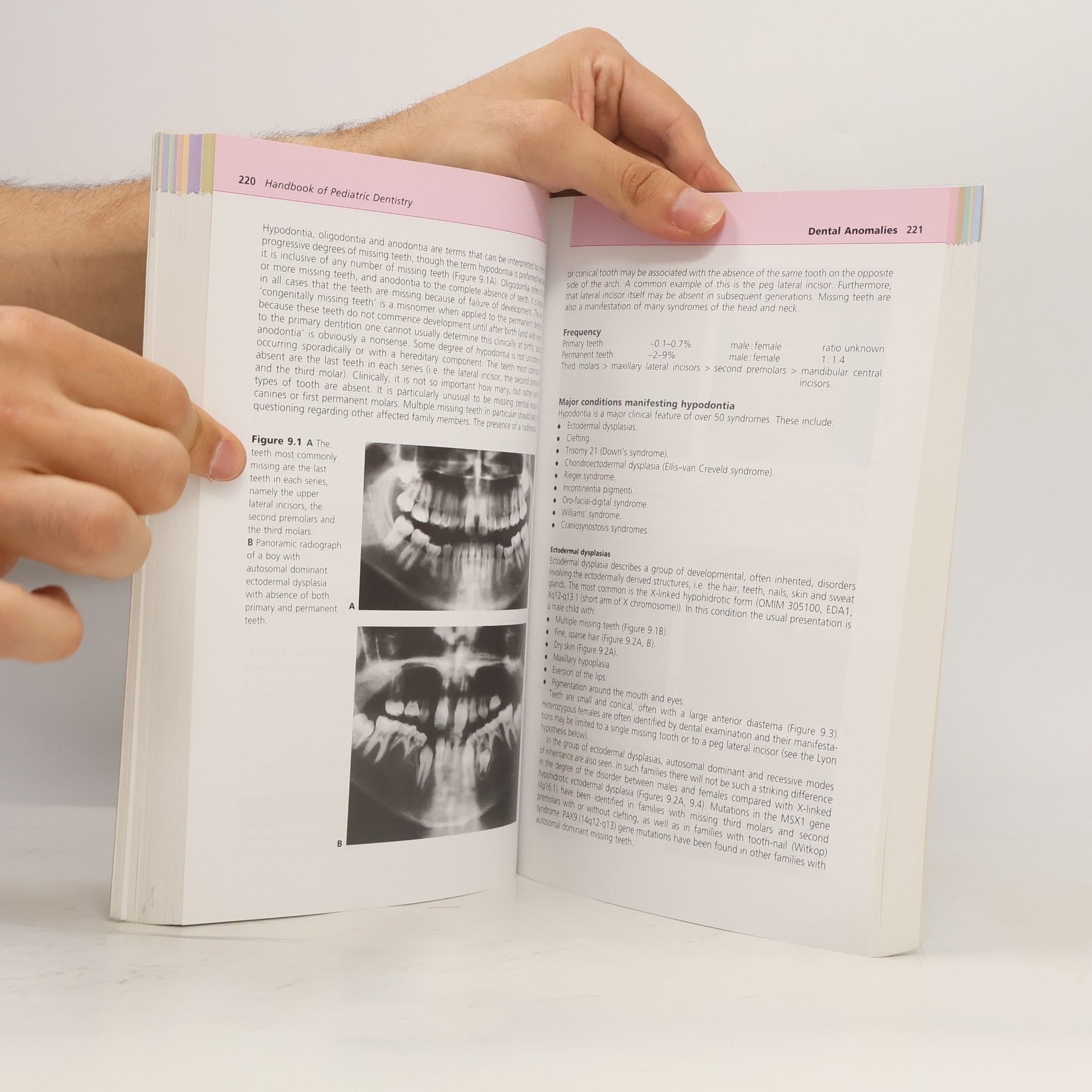 Richard P. Widmer Handbook of Pediatric Dentistry - Third Edition