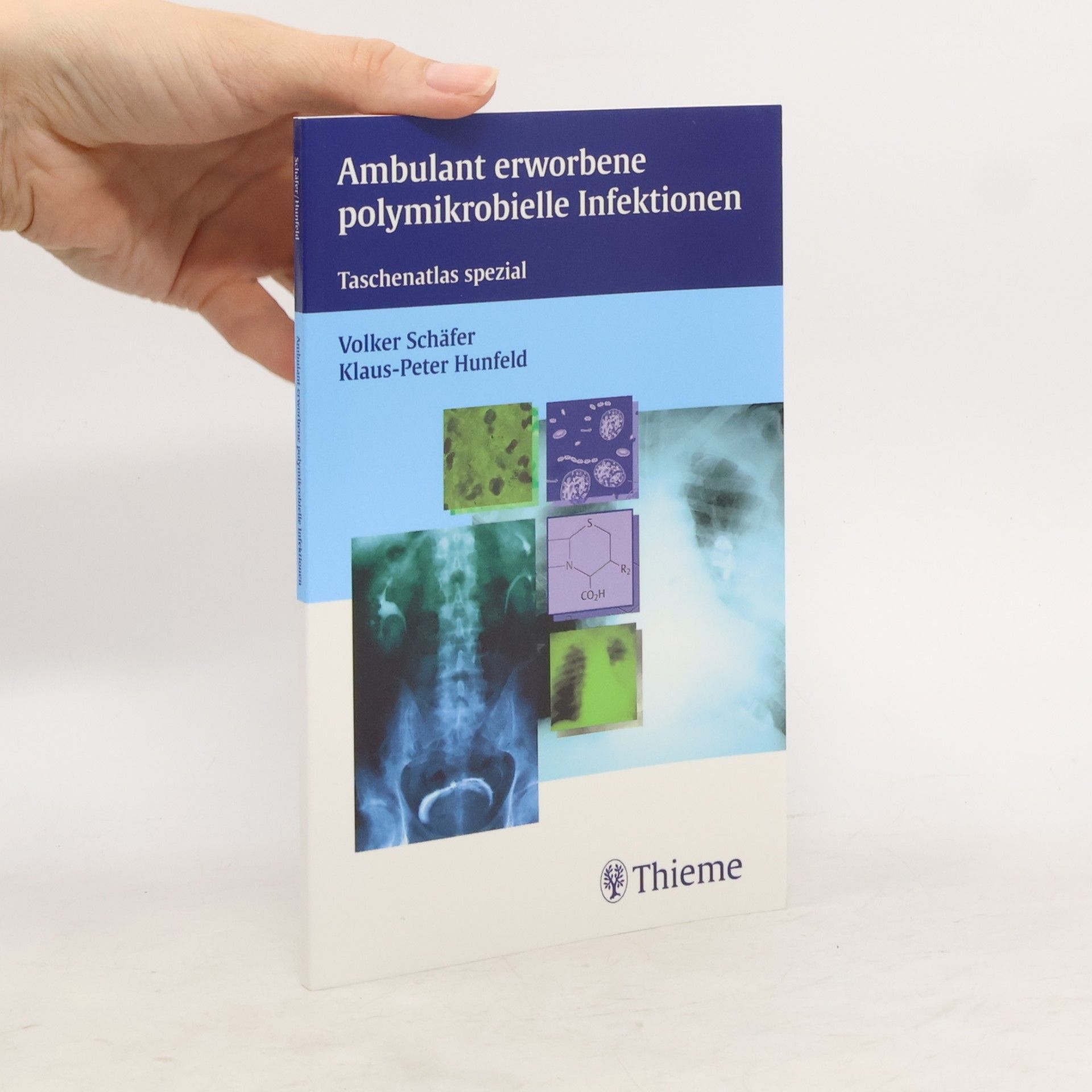 Klaus-Peter Hunfeld Ambulant erworbene polymikrobielle Infektionen