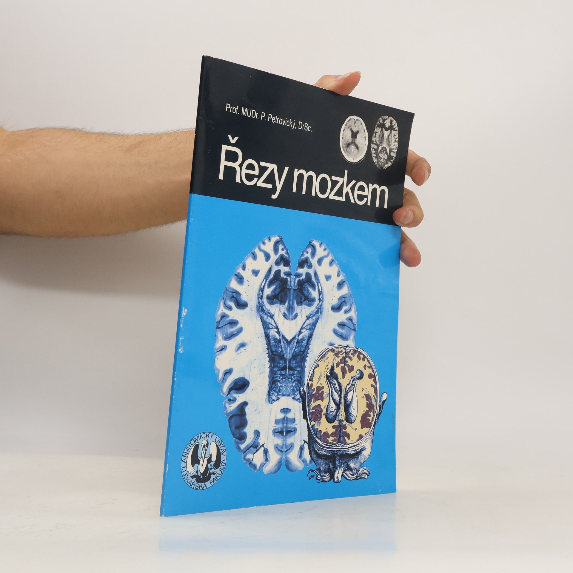 Pavel Petrovický Řezy mozkem : Neuroanatomie, CT, NMR