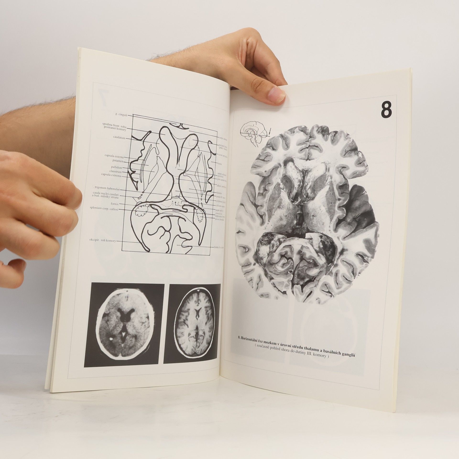 Pavel Petrovický Řezy mozkem : Neuroanatomie, CT, NMR