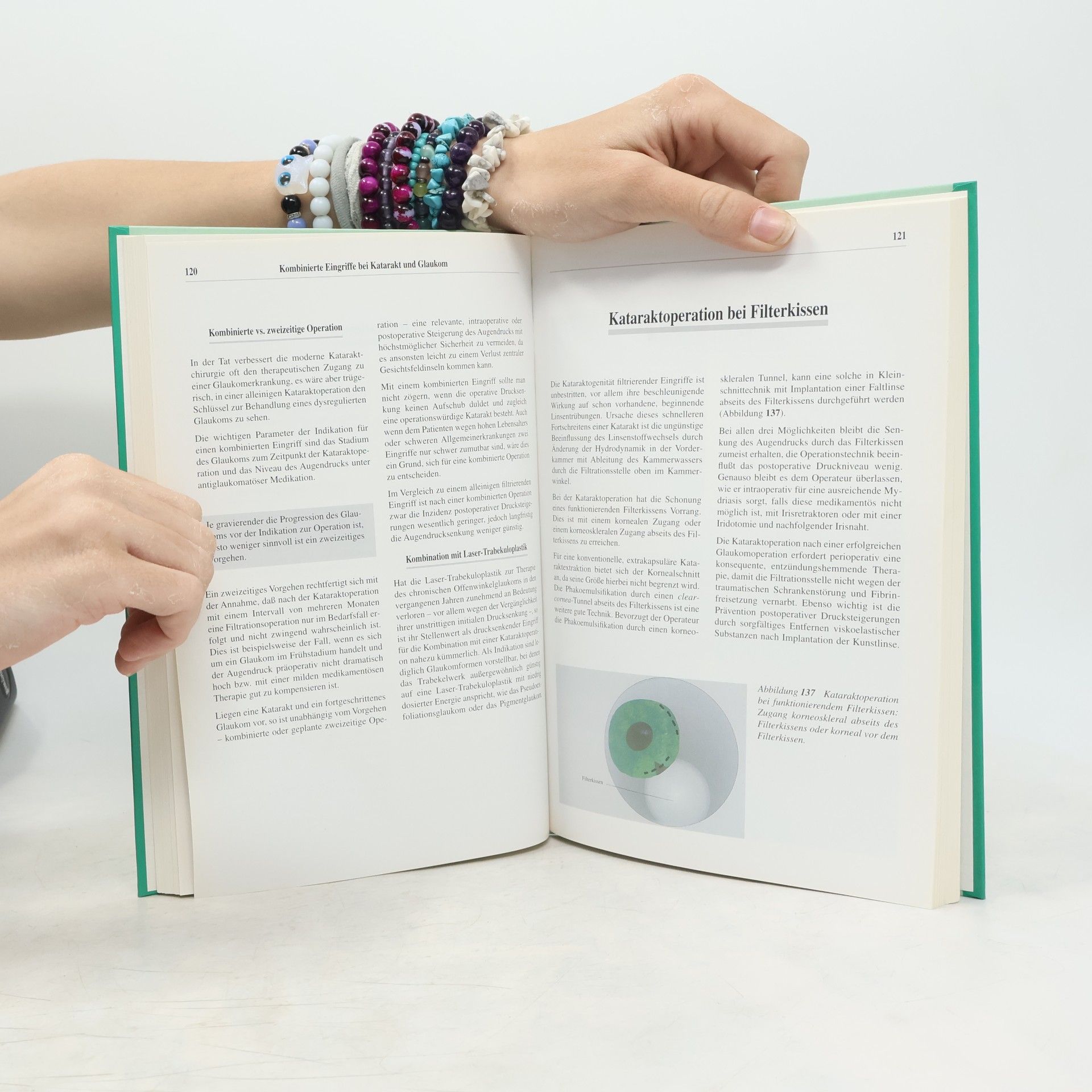 Günter K. Krieglstein Manual der Glaukomchirurgie