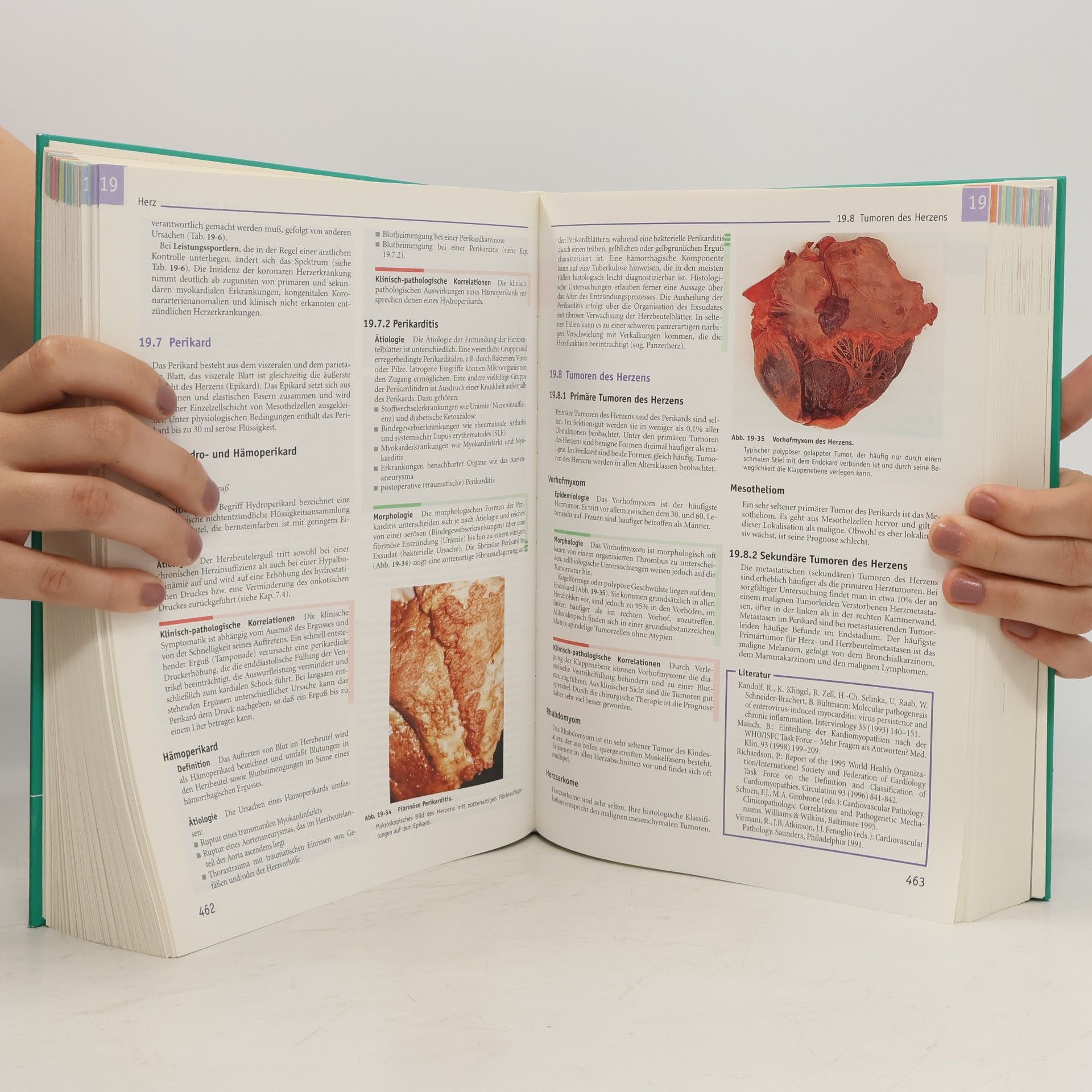 W. Böcker Pathologie