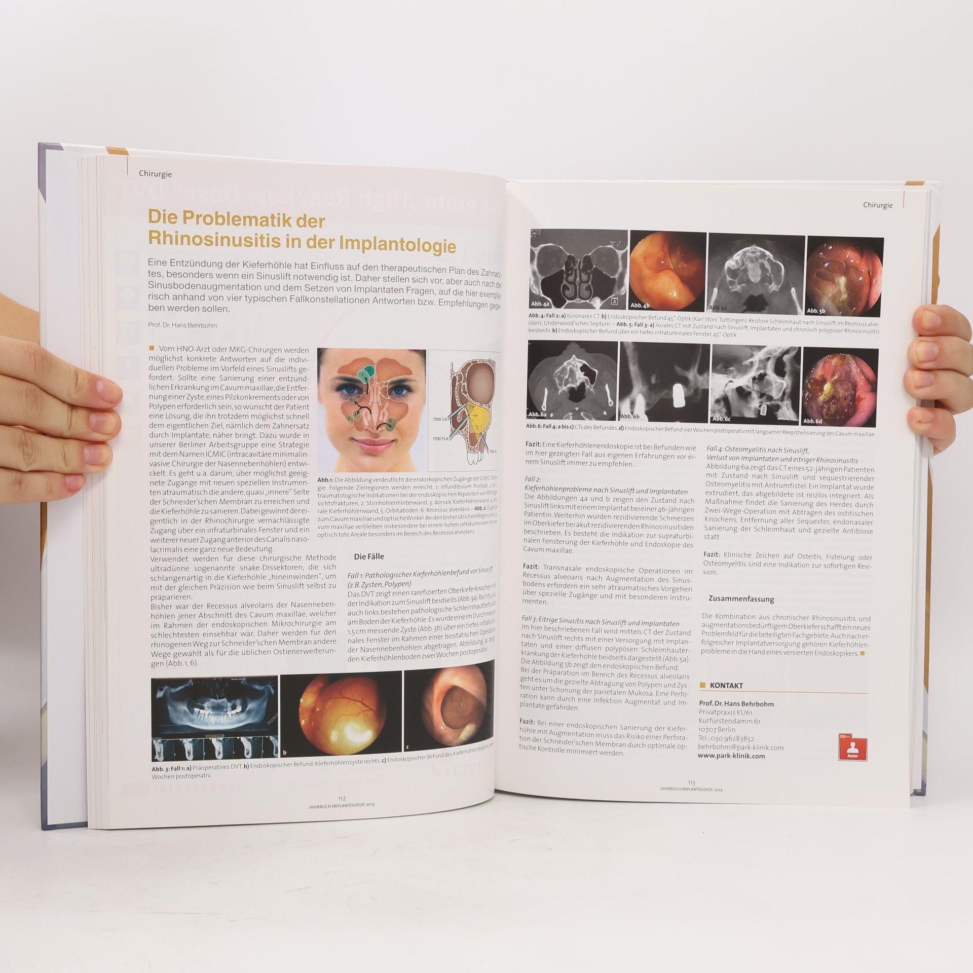 kolektiv Jahrbuch Implantologie 2013